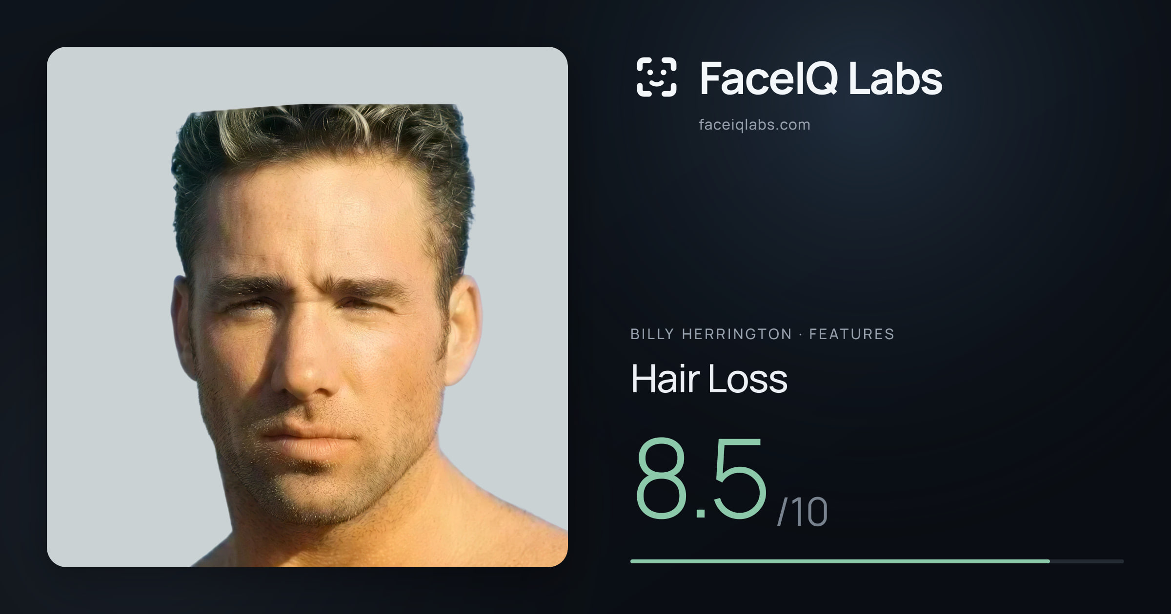Billy Herrington Hair Loss: 8.5/10, drawn on the photo