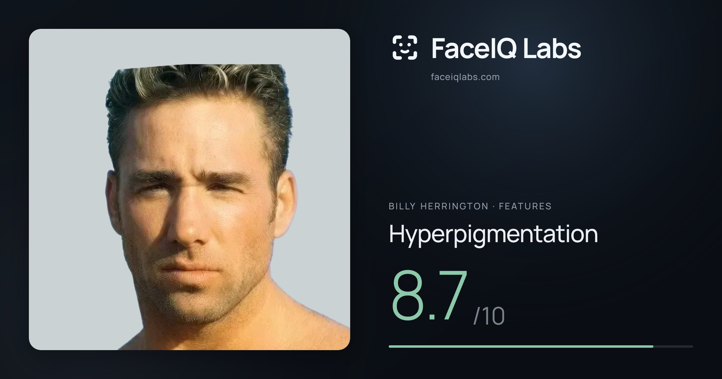 Billy Herrington Hyperpigmentation: 8.7/10, drawn on the photo