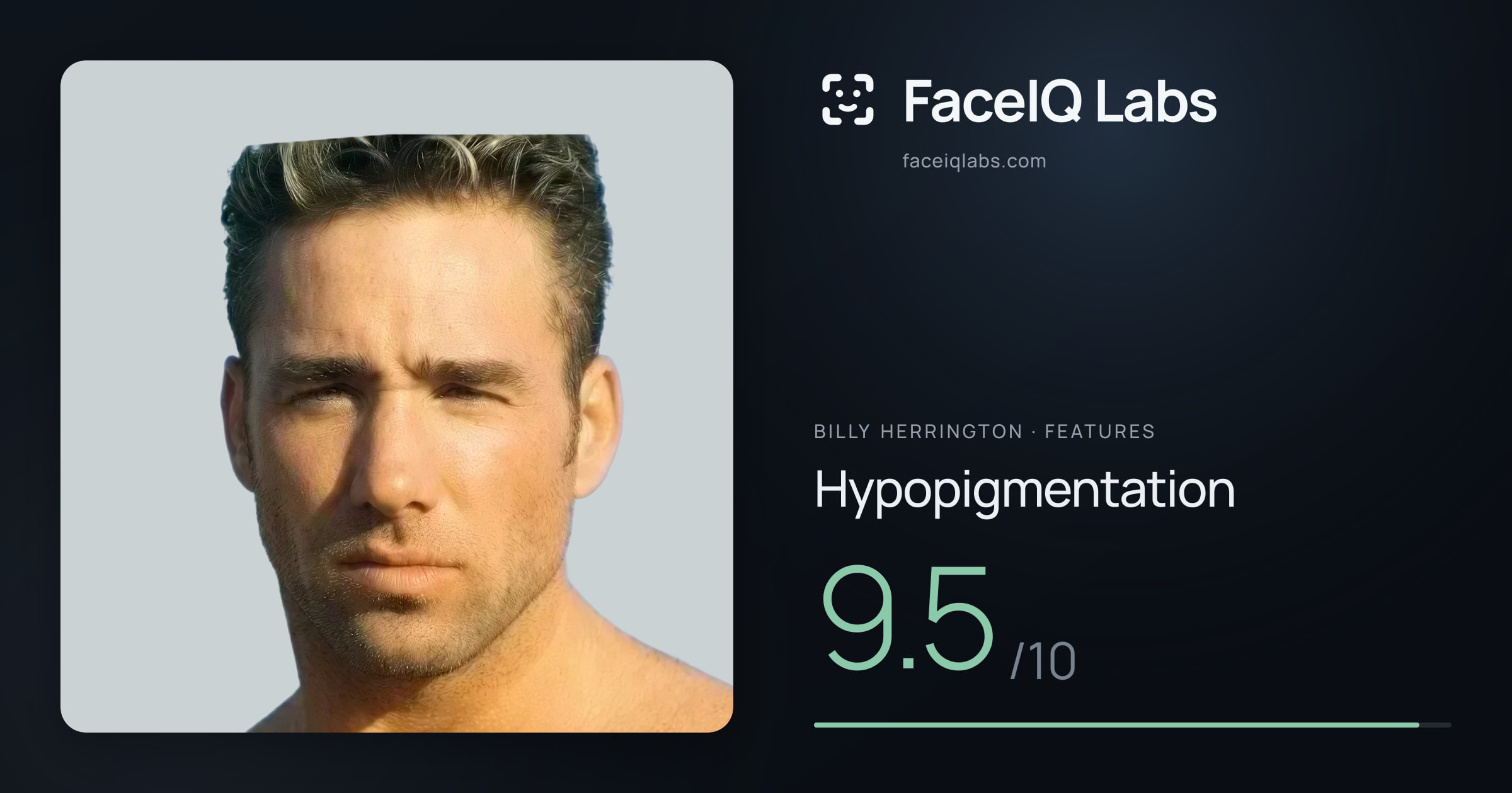 Billy Herrington Hypopigmentation: 9.5/10, drawn on the photo
