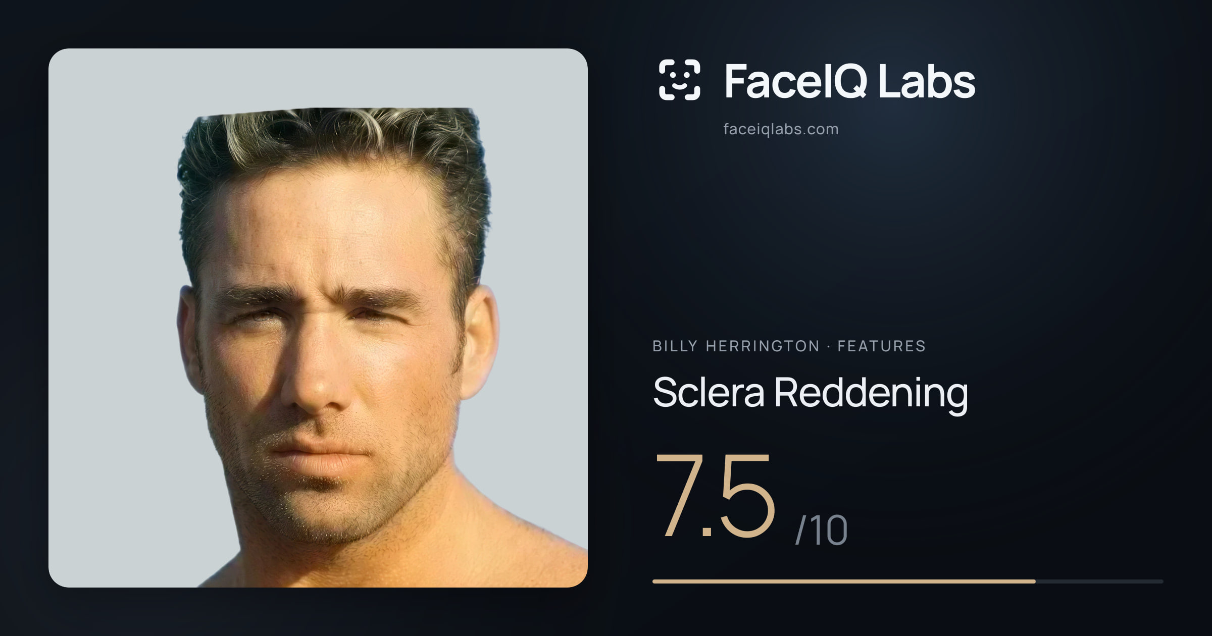Billy Herrington Sclera Reddening: 7.5/10, drawn on the photo