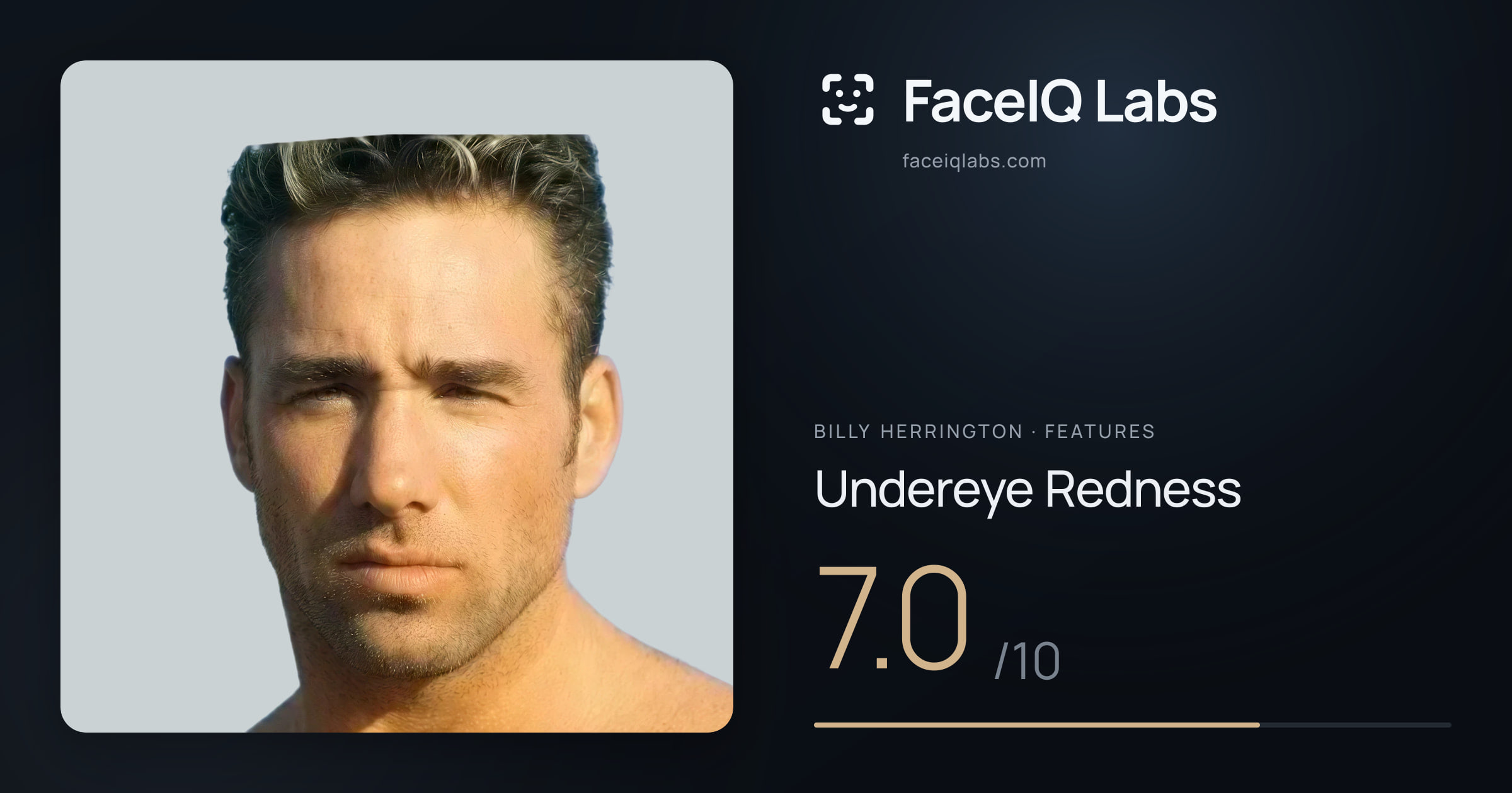 Billy Herrington Undereye Redness: 7.0/10, drawn on the photo
