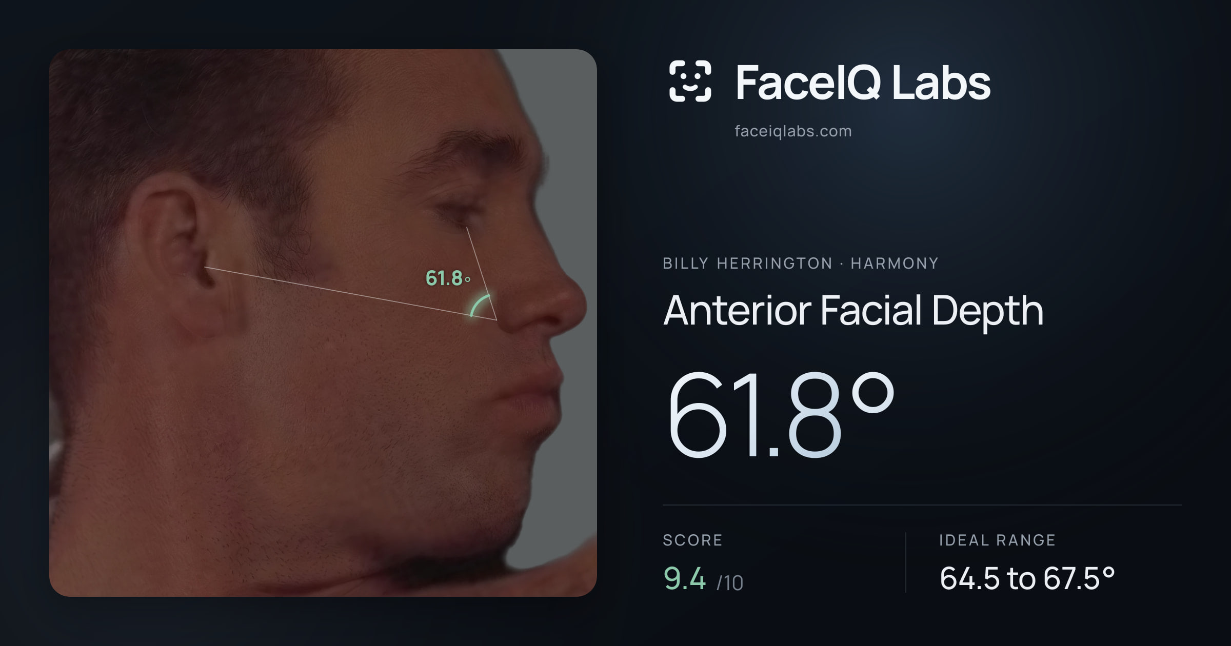 Billy Herrington Anterior Facial Depth: 61.8°, drawn on the photo