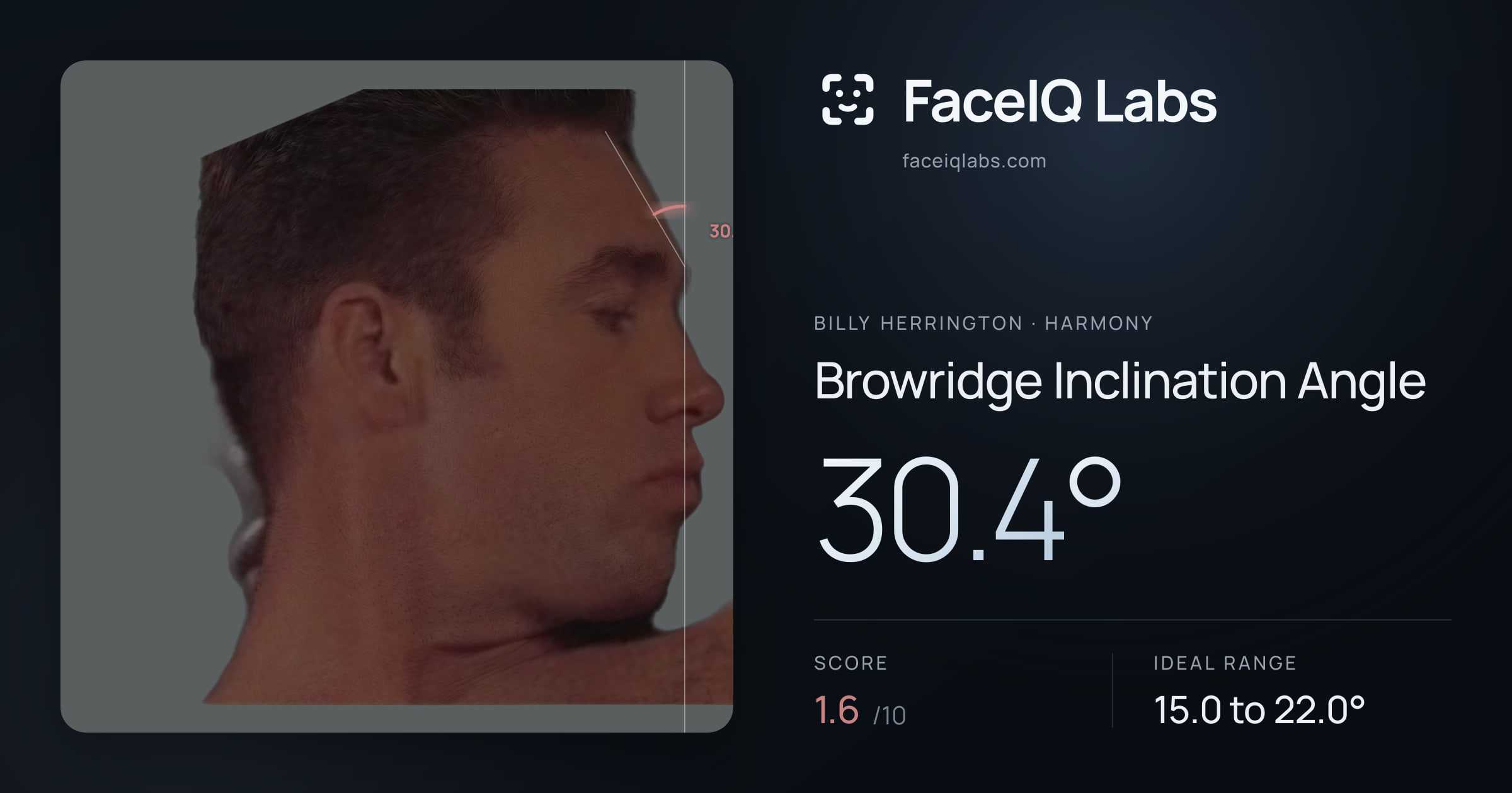 Billy Herrington Browridge Inclination Angle: 30.4°, drawn on the photo