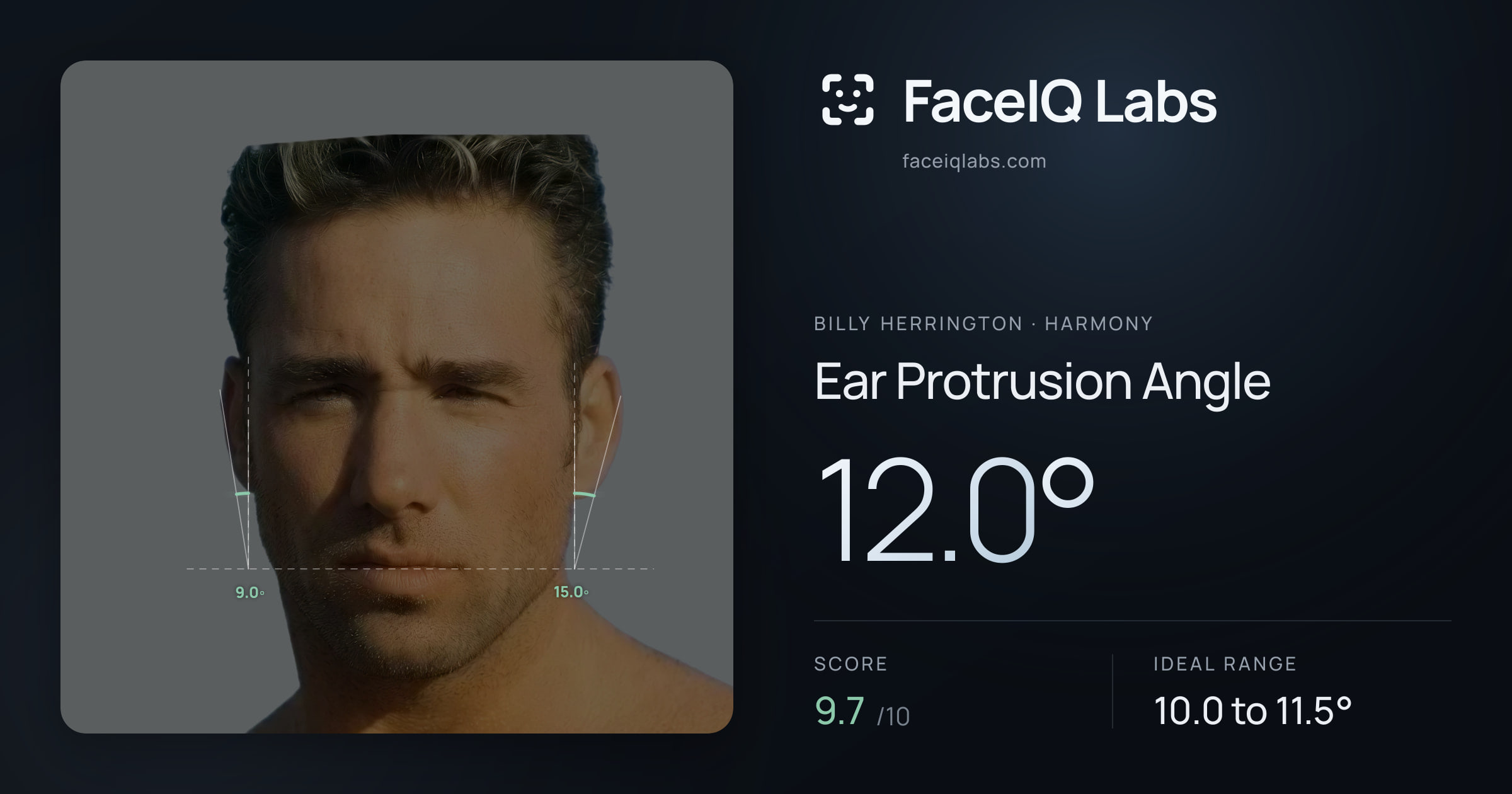 Billy Herrington Ear Protrusion Angle: 12.0°, drawn on the photo