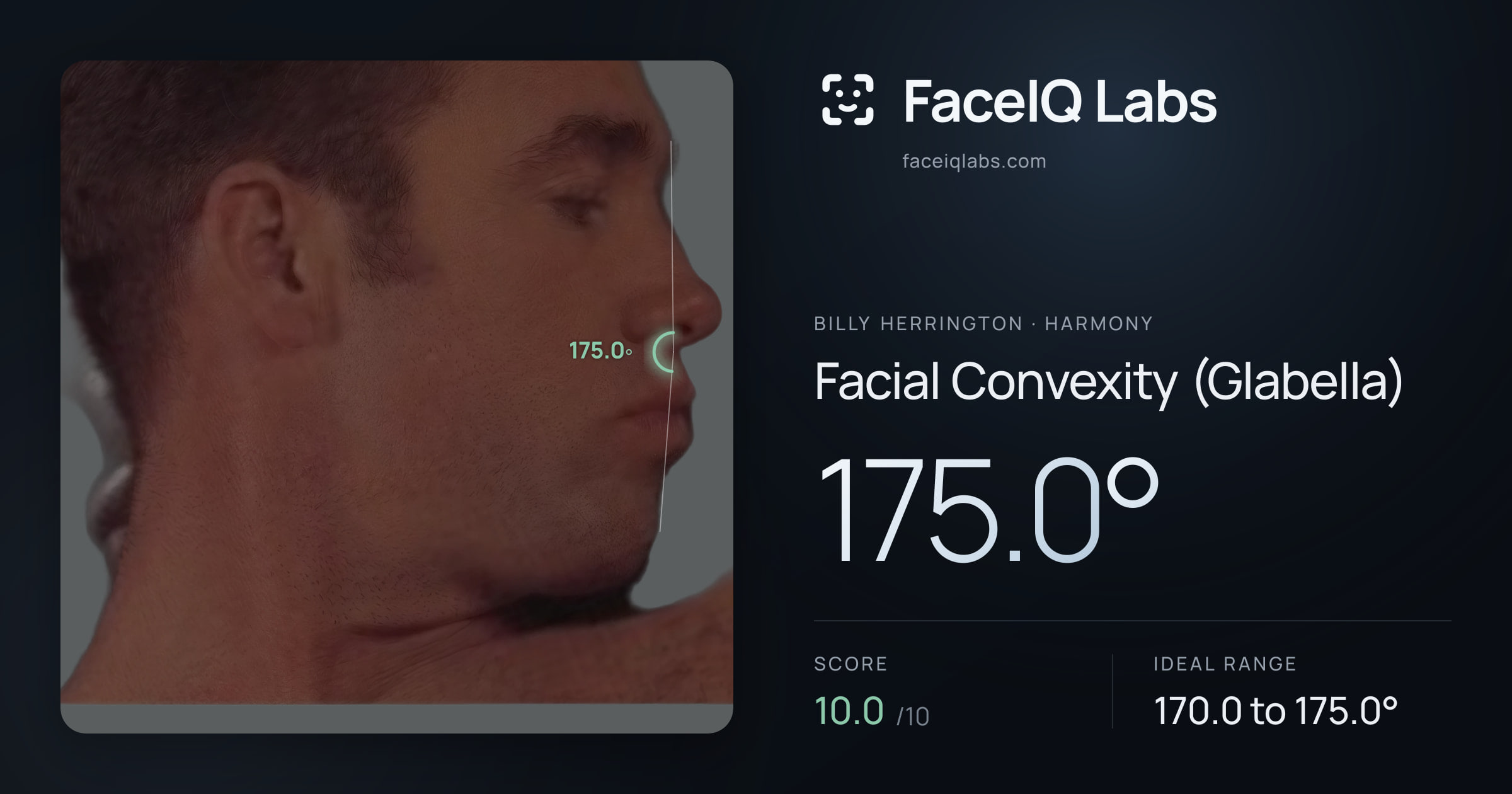 Billy Herrington Facial Convexity (Glabella): 175.0°, drawn on the photo
