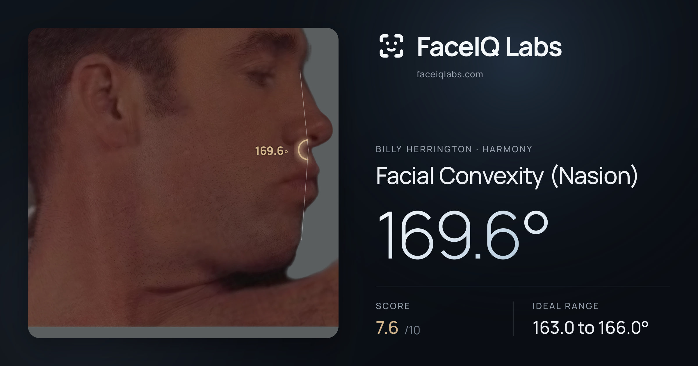 Billy Herrington Facial Convexity (Nasion): 169.6°, drawn on the photo