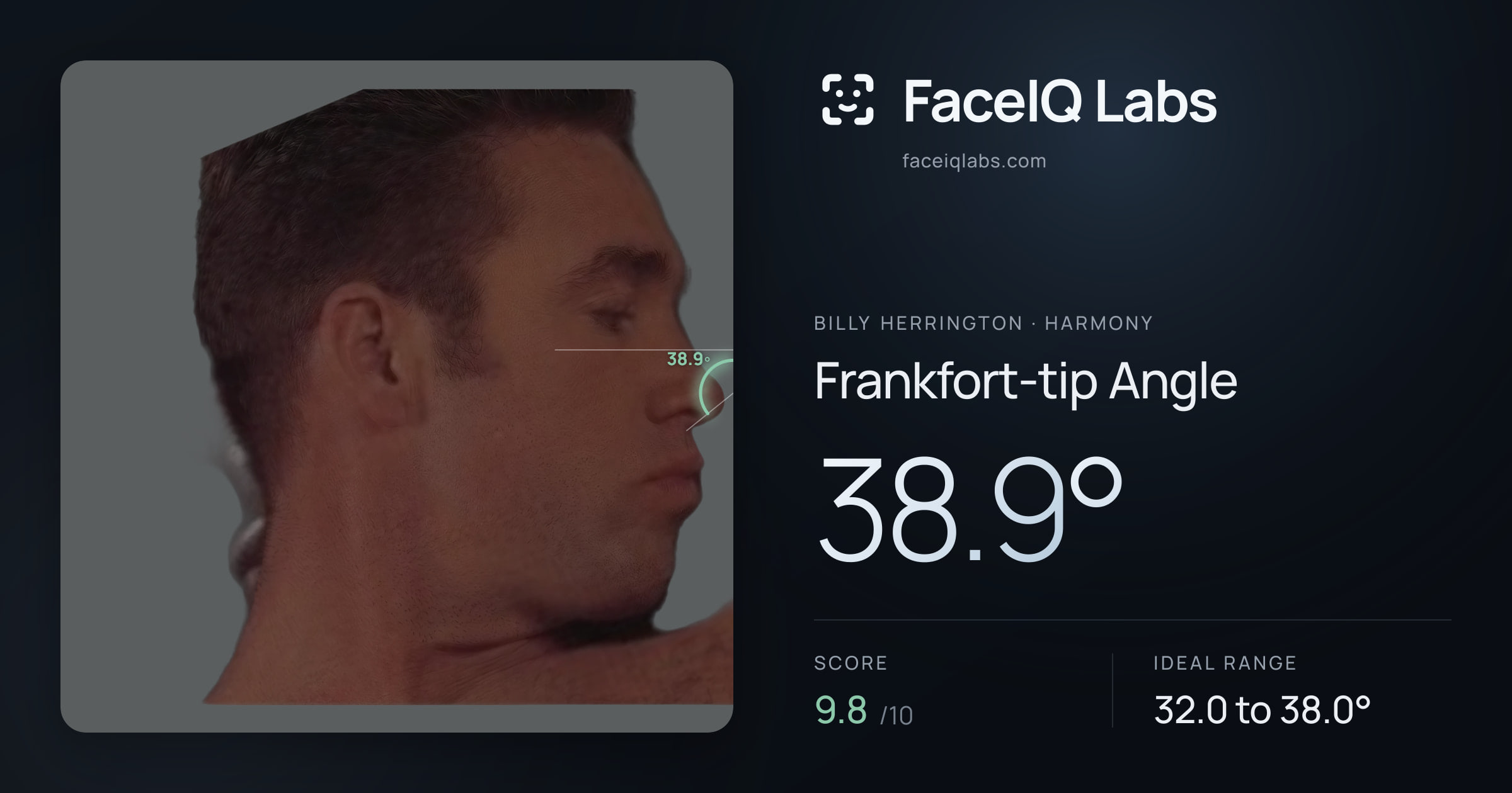 Billy Herrington Frankfort-tip Angle: 38.9°, drawn on the photo