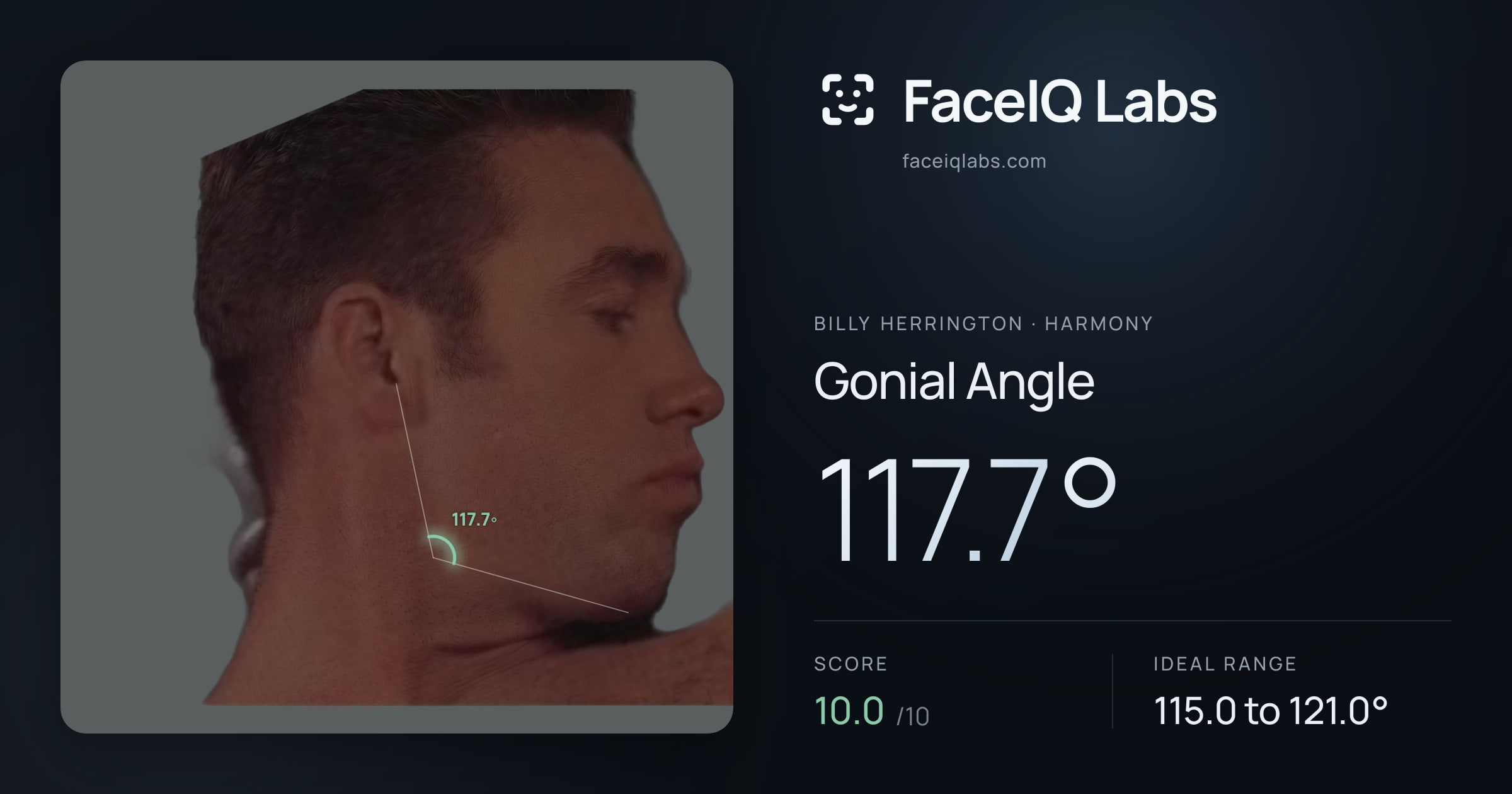 Billy Herrington Gonial Angle: 117.7°, drawn on the photo