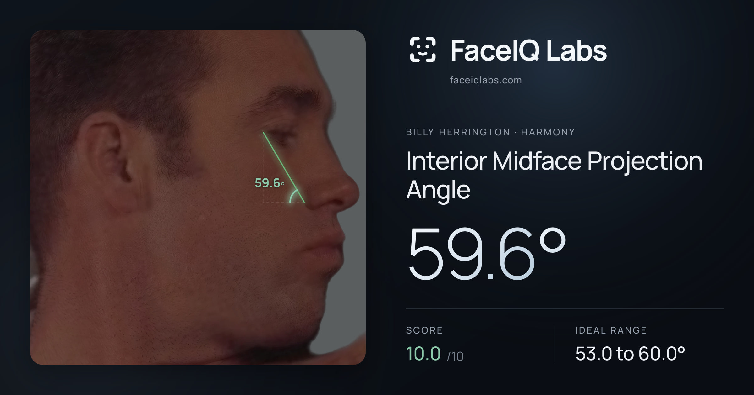 Billy Herrington Interior Midface Projection Angle: 59.6°, drawn on the photo
