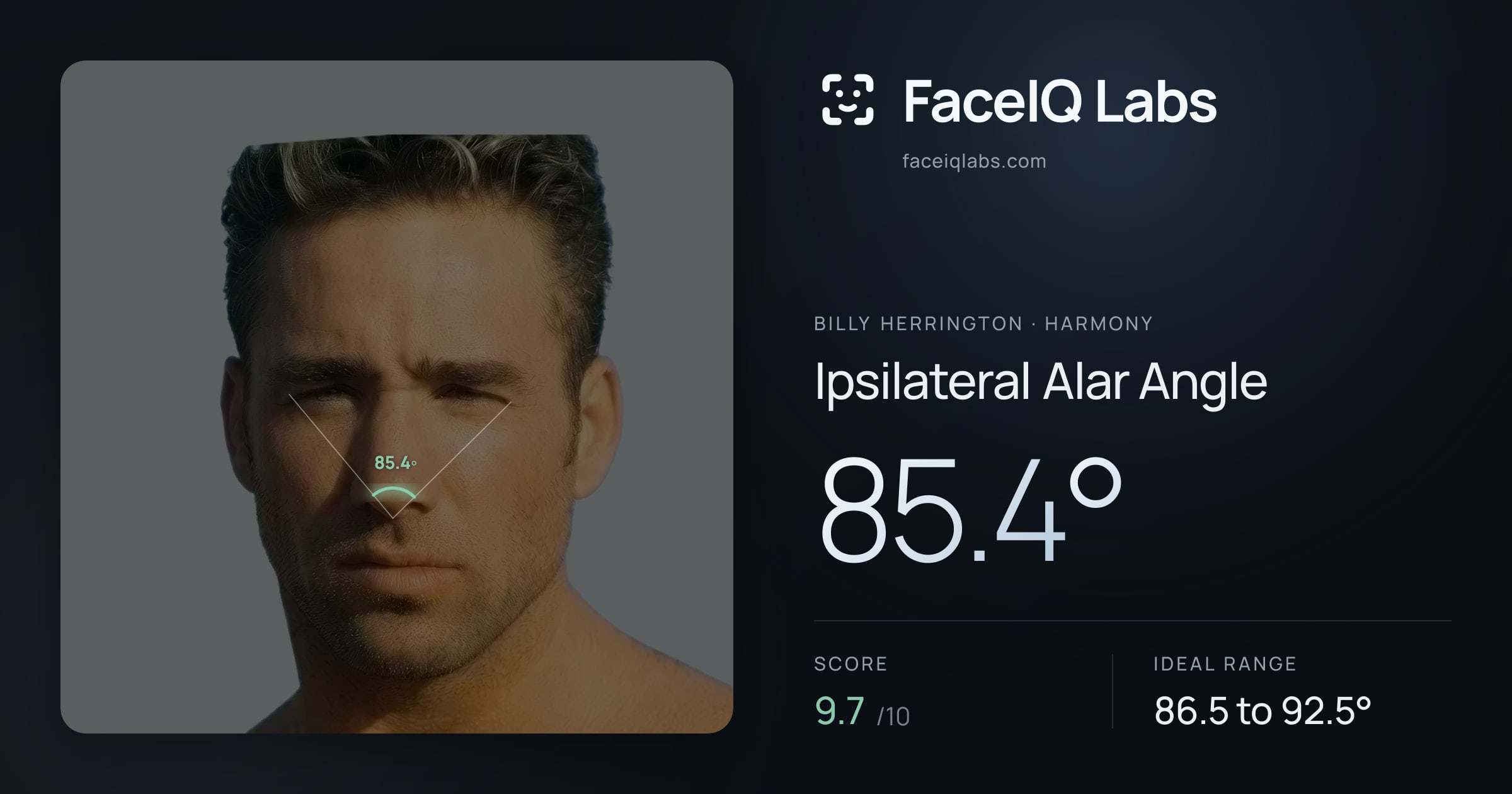 Billy Herrington Ipsilateral Alar Angle: 85.4°, drawn on the photo