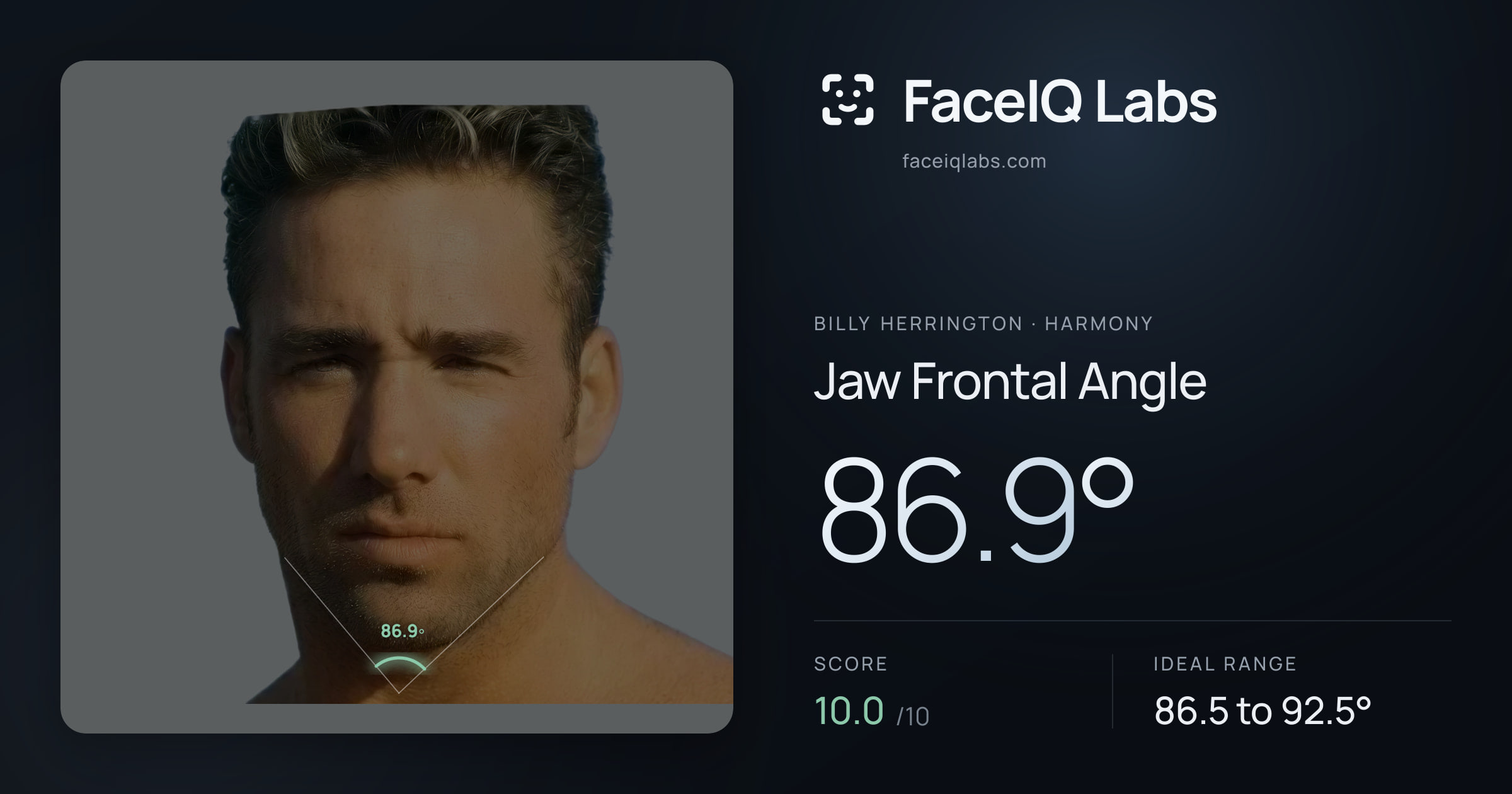 Billy Herrington Jaw Frontal Angle: 86.9°, drawn on the photo