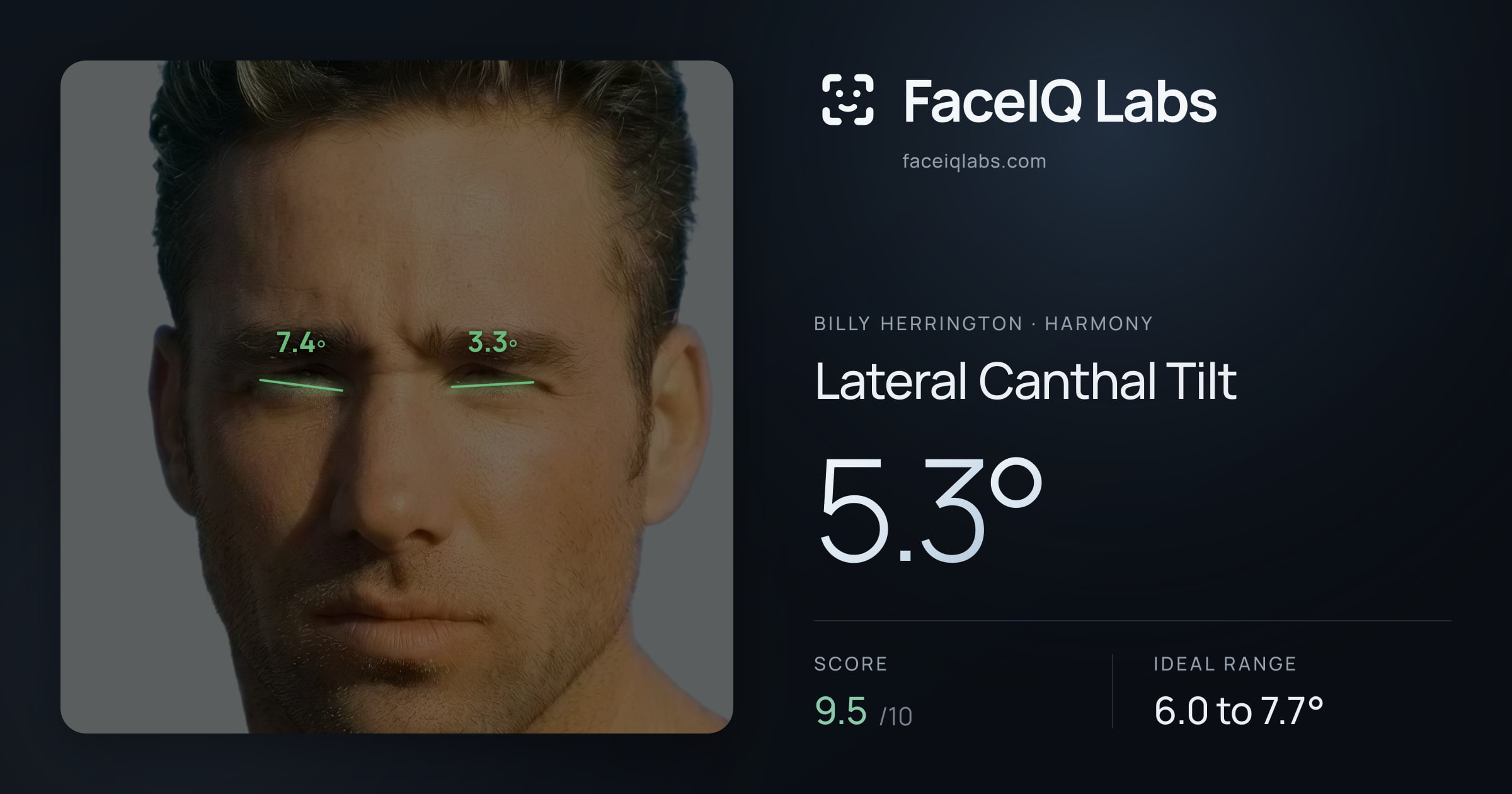 Billy Herrington Lateral Canthal Tilt: 5.3°, drawn on the photo