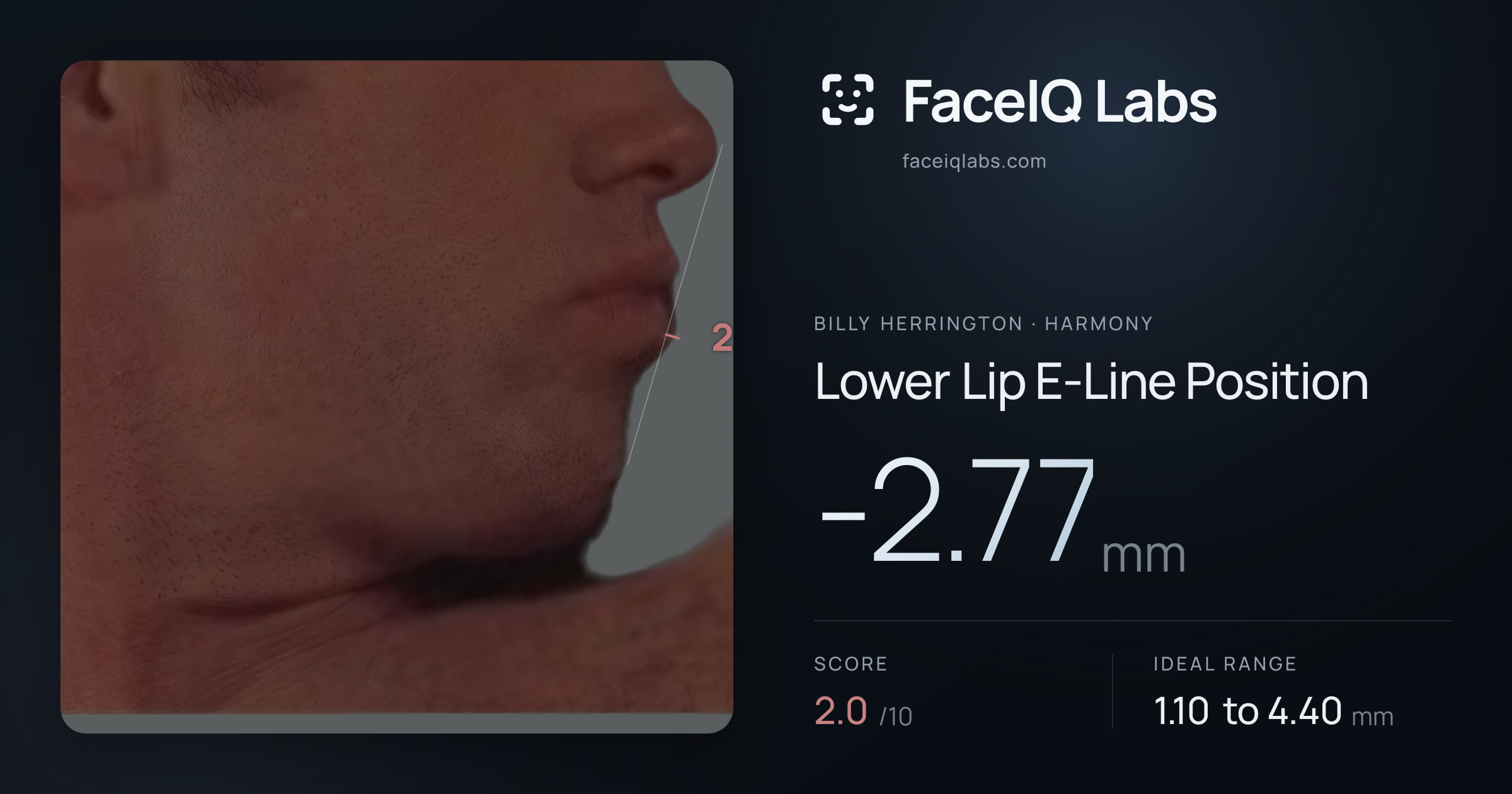 Billy Herrington Lower Lip E-Line Position: -2.77mm, drawn on the photo
