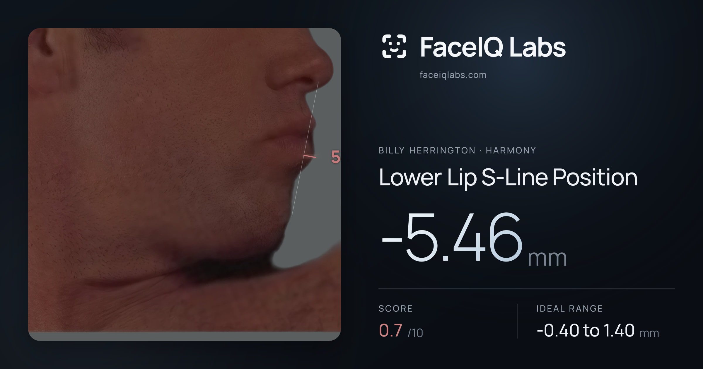 Billy Herrington Lower Lip S-Line Position: -5.46mm, drawn on the photo