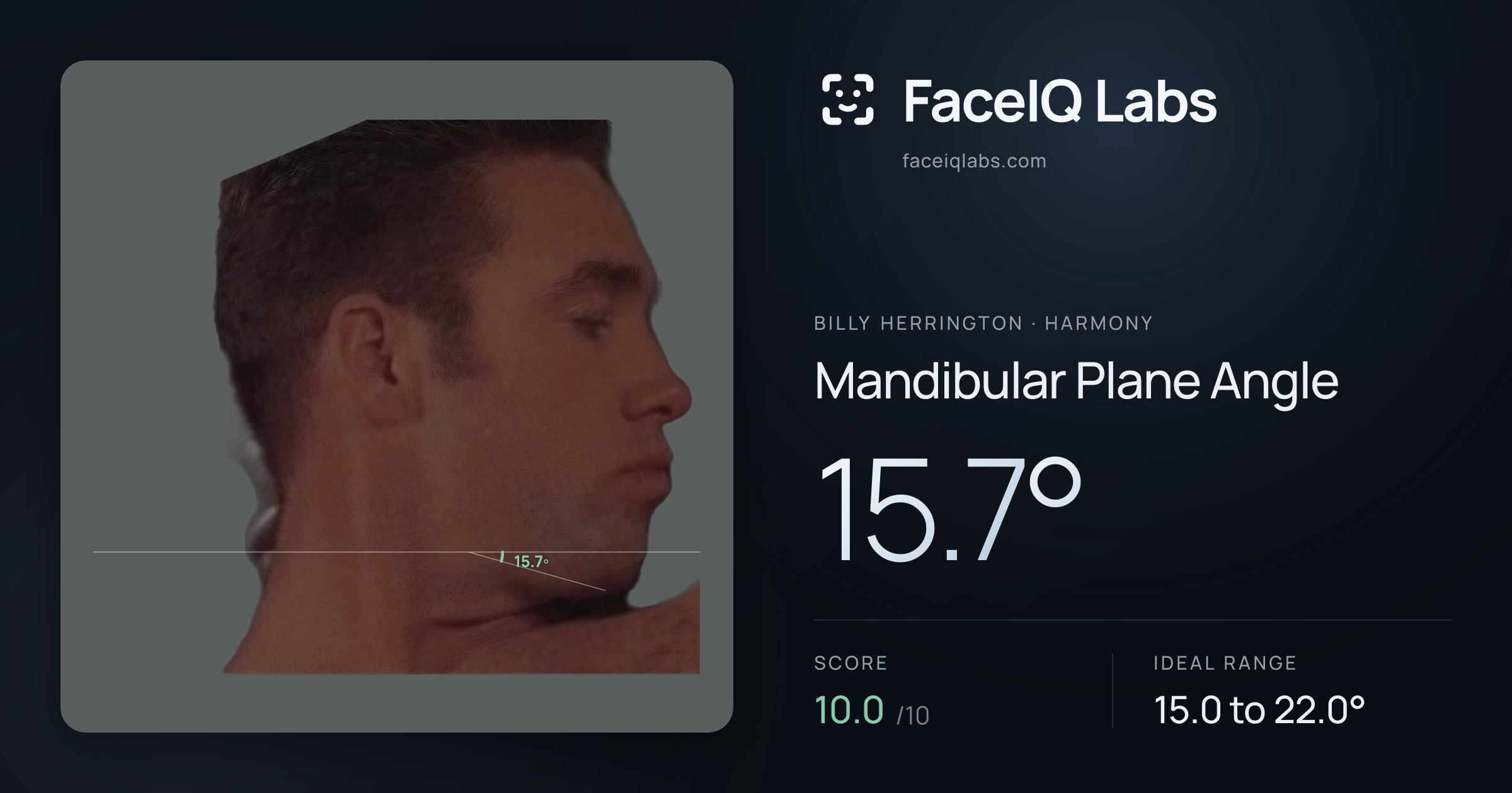 Billy Herrington Mandibular Plane Angle: 15.7°, drawn on the photo