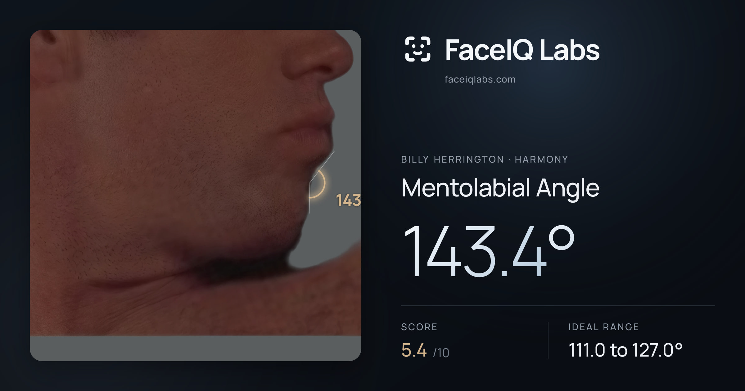 Billy Herrington Mentolabial Angle: 143.4°, drawn on the photo