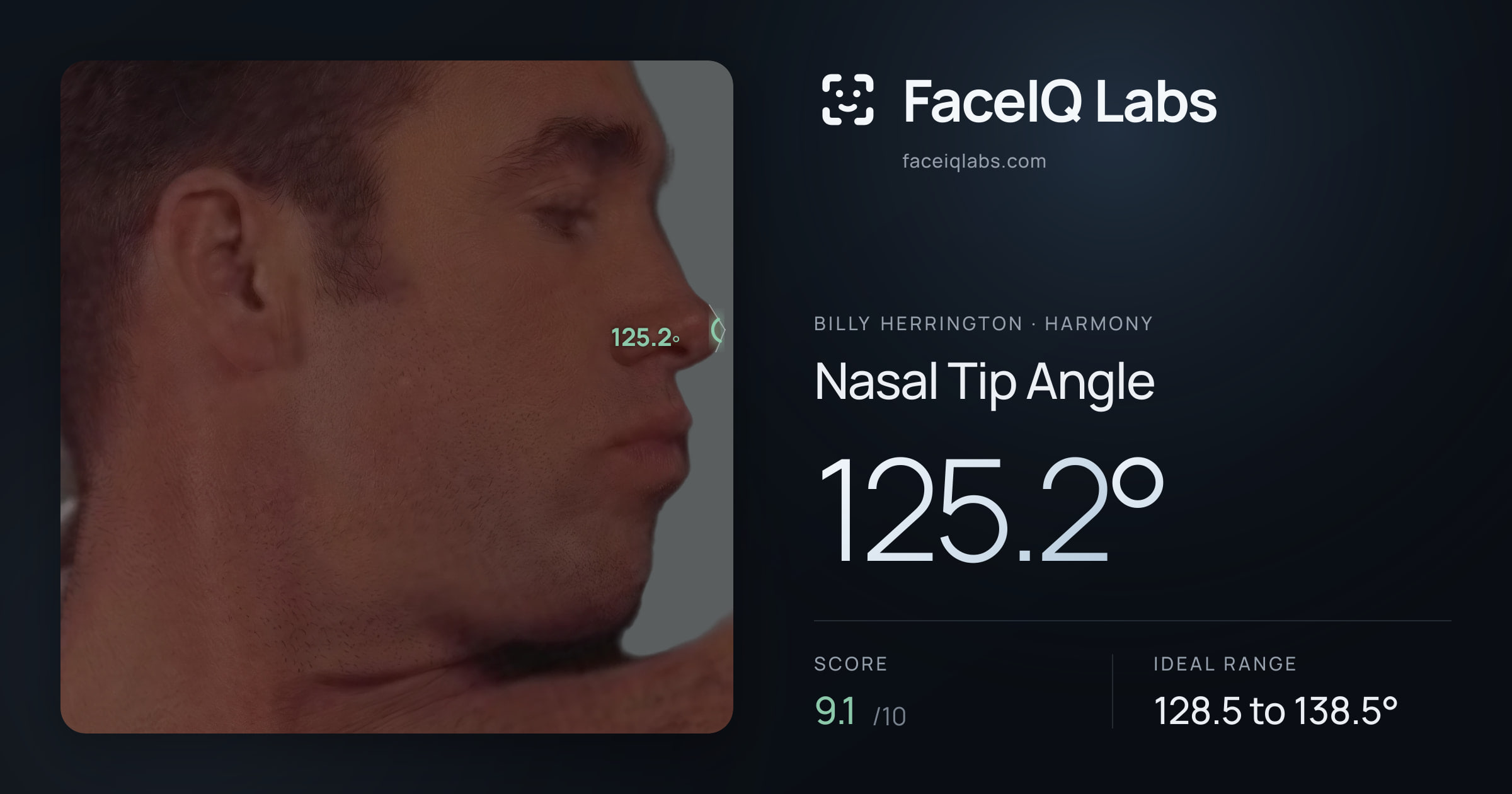 Billy Herrington Nasal Tip Angle: 125.2°, drawn on the photo