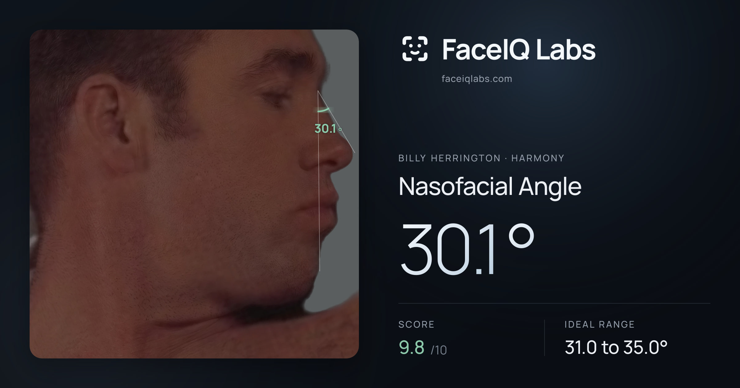 Billy Herrington Nasofacial Angle: 30.1°, drawn on the photo
