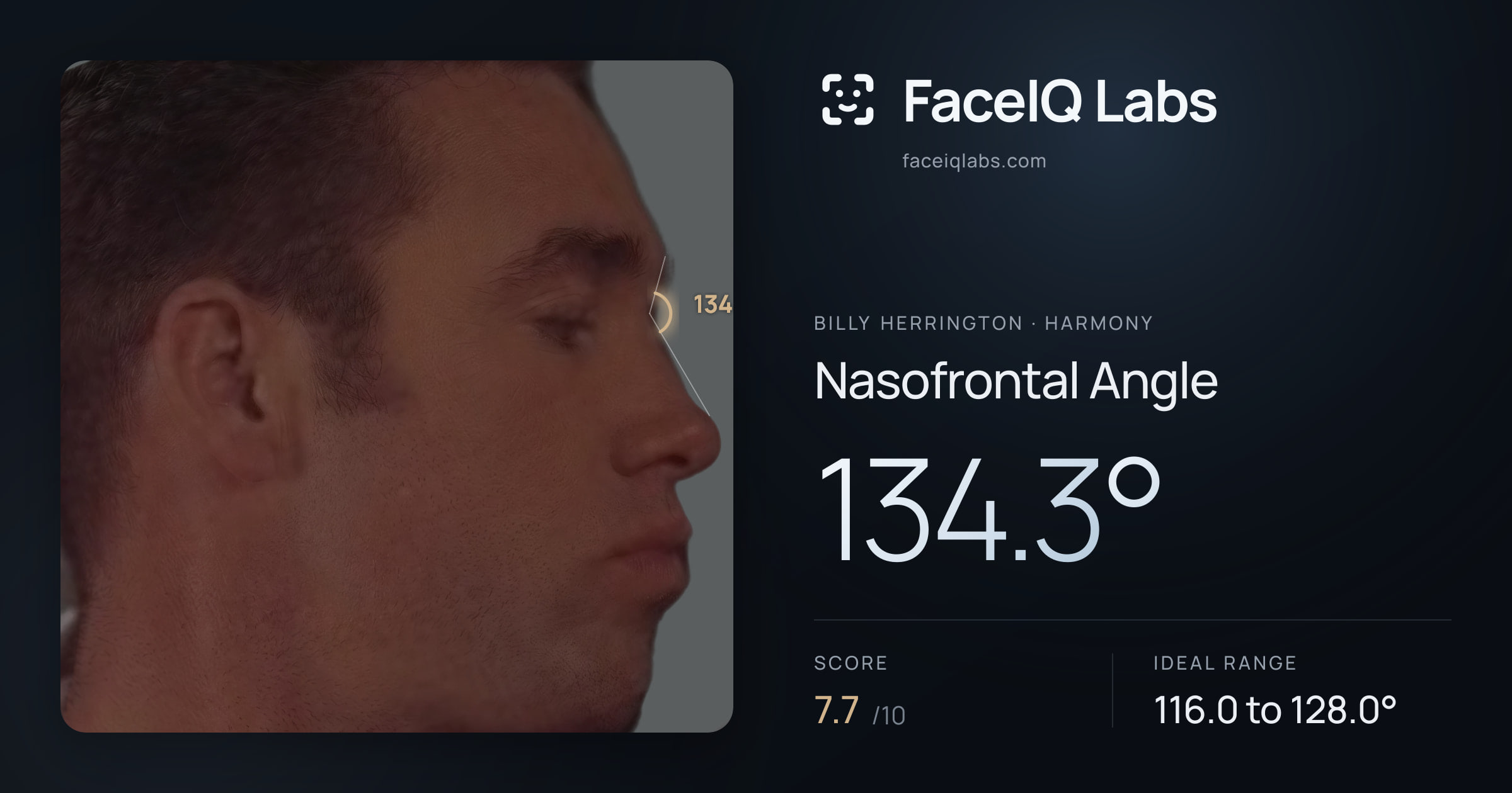 Billy Herrington Nasofrontal Angle: 134.3°, drawn on the photo