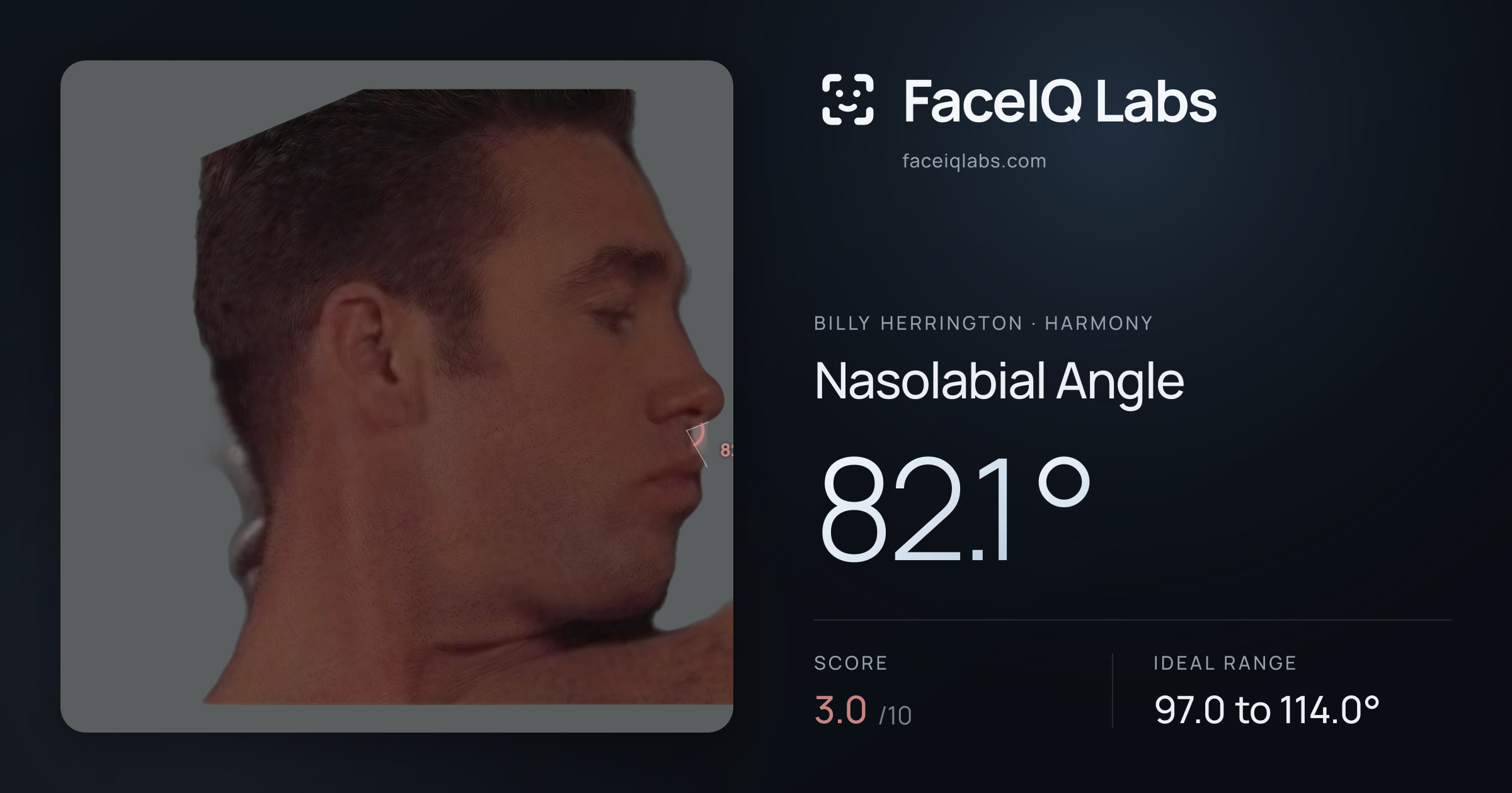 Billy Herrington Nasolabial Angle: 82.1°, drawn on the photo