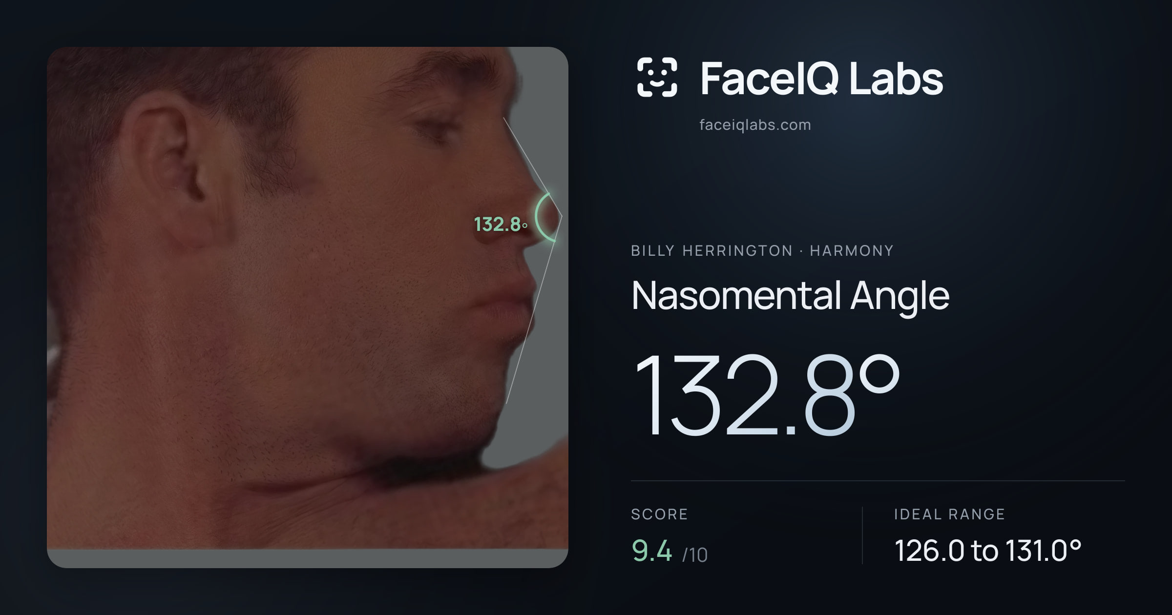 Billy Herrington Nasomental Angle: 132.8°, drawn on the photo