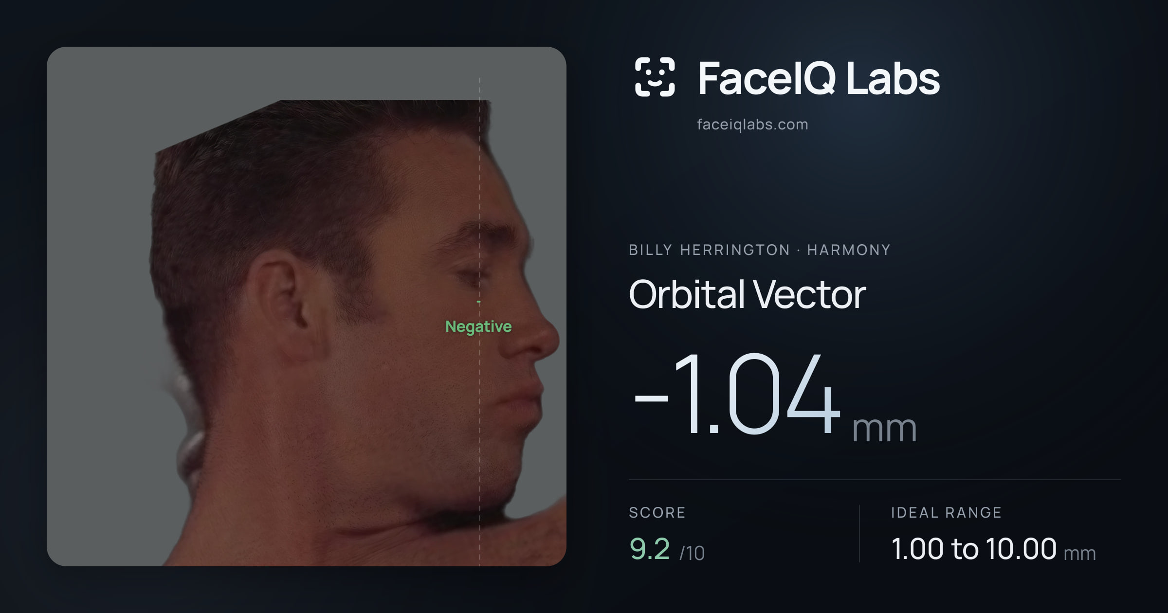 Billy Herrington Orbital Vector: -1.04mm, drawn on the photo