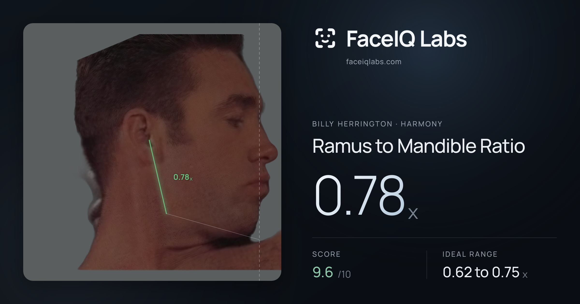 Billy Herrington Ramus to Mandible Ratio: 0.78x, drawn on the photo