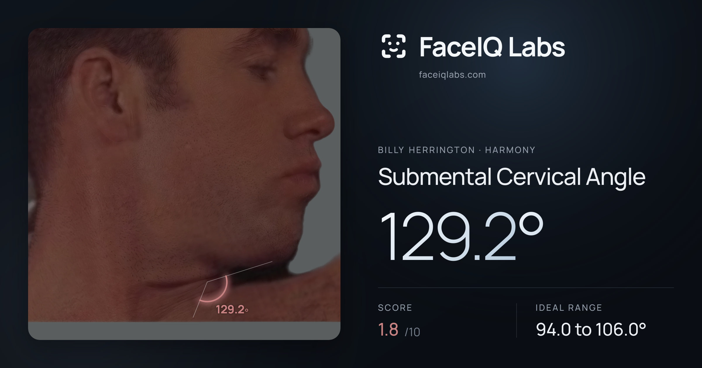 Billy Herrington Submental Cervical Angle: 129.2°, drawn on the photo