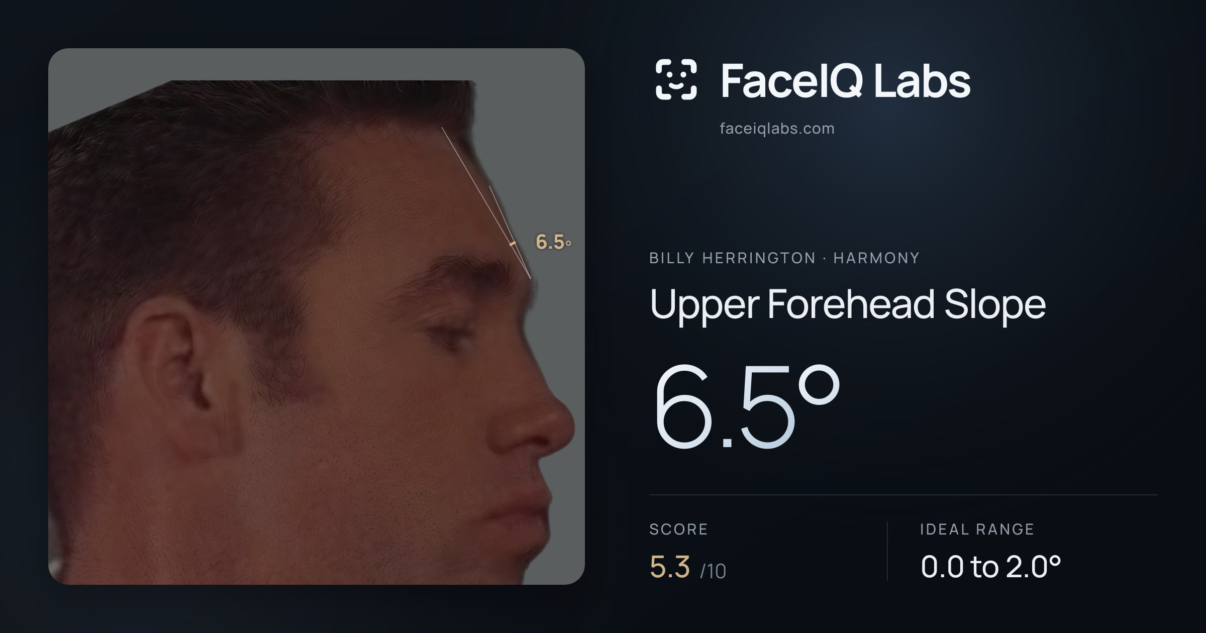 Billy Herrington Upper Forehead Slope: 6.5°, drawn on the photo