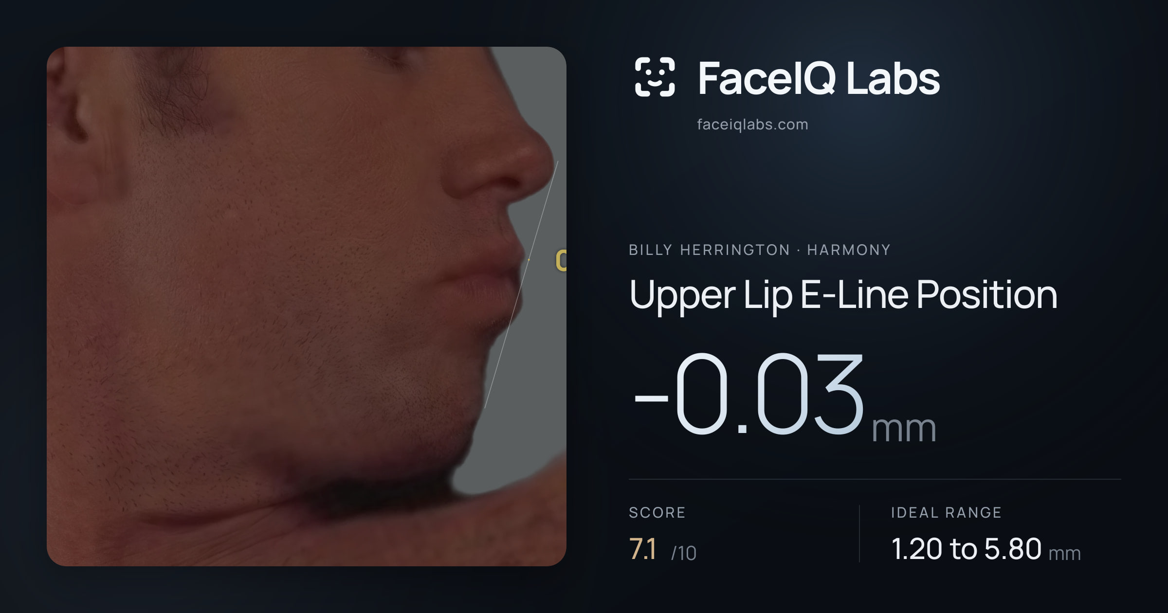 Billy Herrington Upper Lip E-Line Position: -0.03mm, drawn on the photo