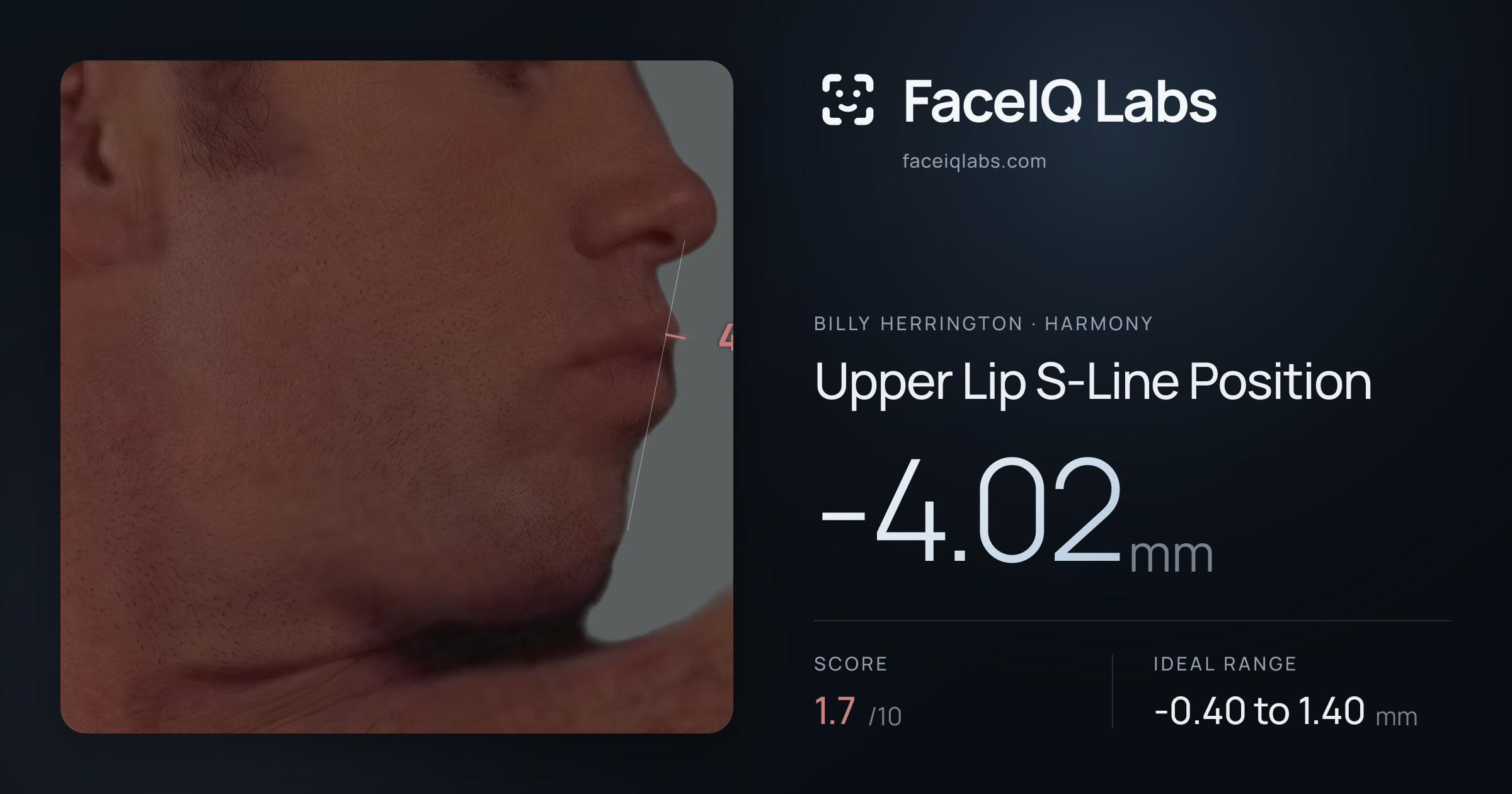 Billy Herrington Upper Lip S-Line Position: -4.02mm, drawn on the photo