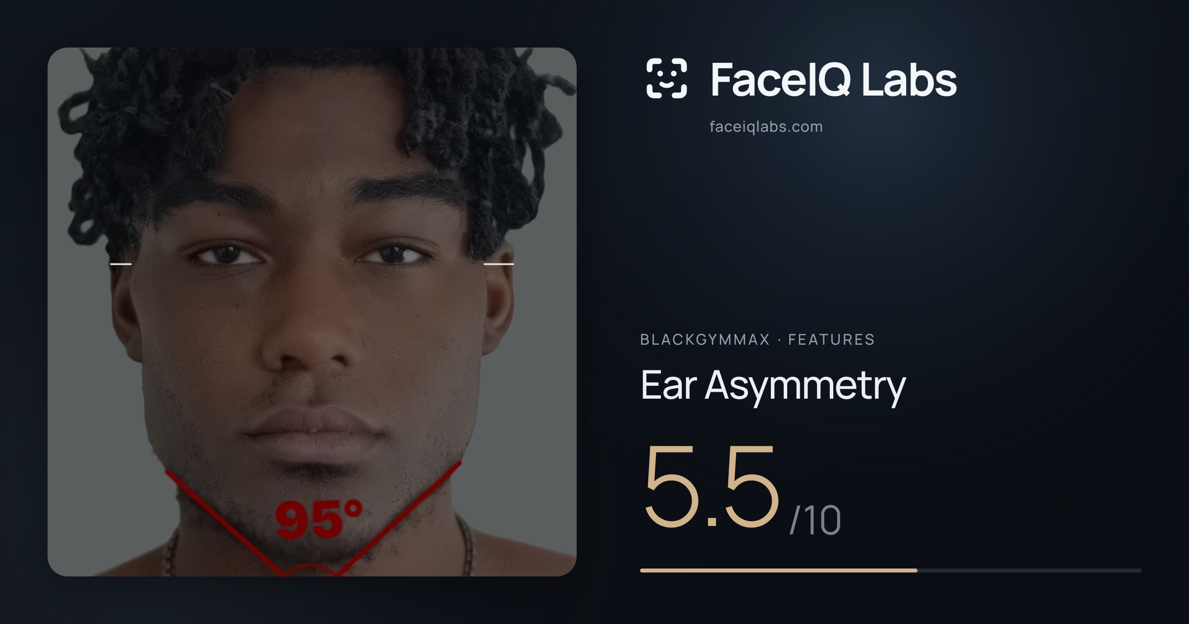 Blackgymmax Ear Asymmetry: 5.5/10, drawn on the photo