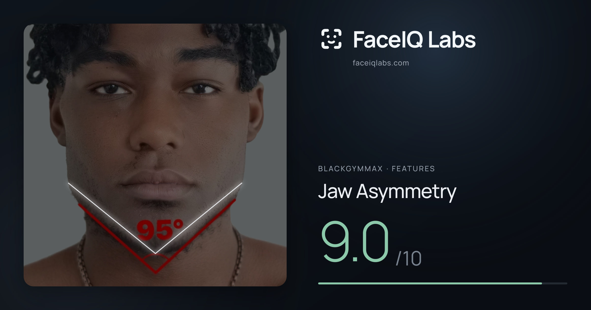 Blackgymmax Jaw Asymmetry: 9.0/10, drawn on the photo