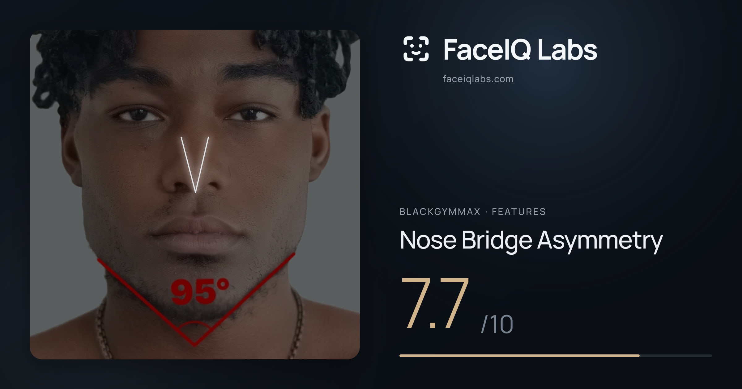 Blackgymmax Nose Bridge Asymmetry: 7.7/10, drawn on the photo