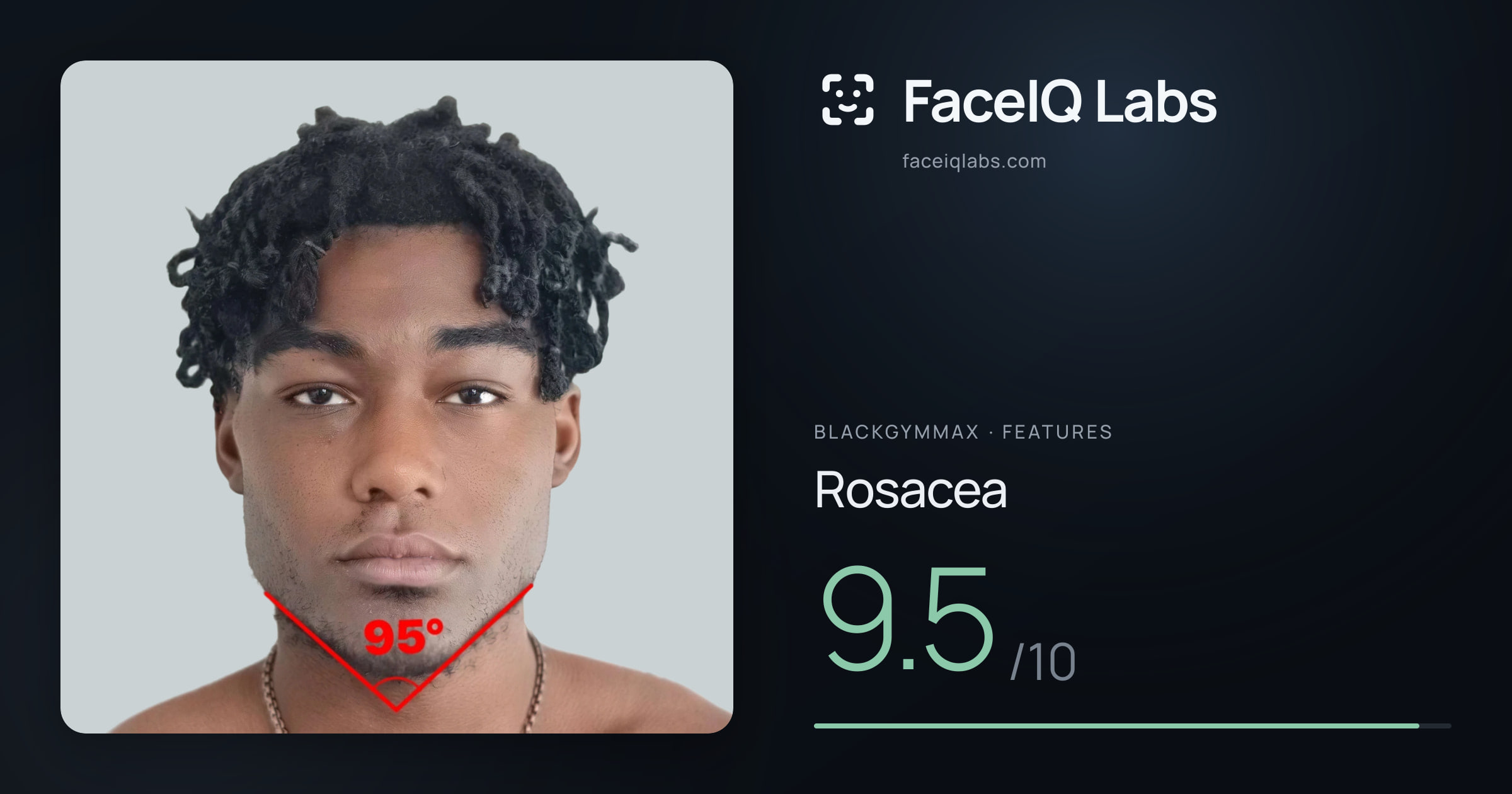 Blackgymmax Rosacea: 9.5/10, drawn on the photo