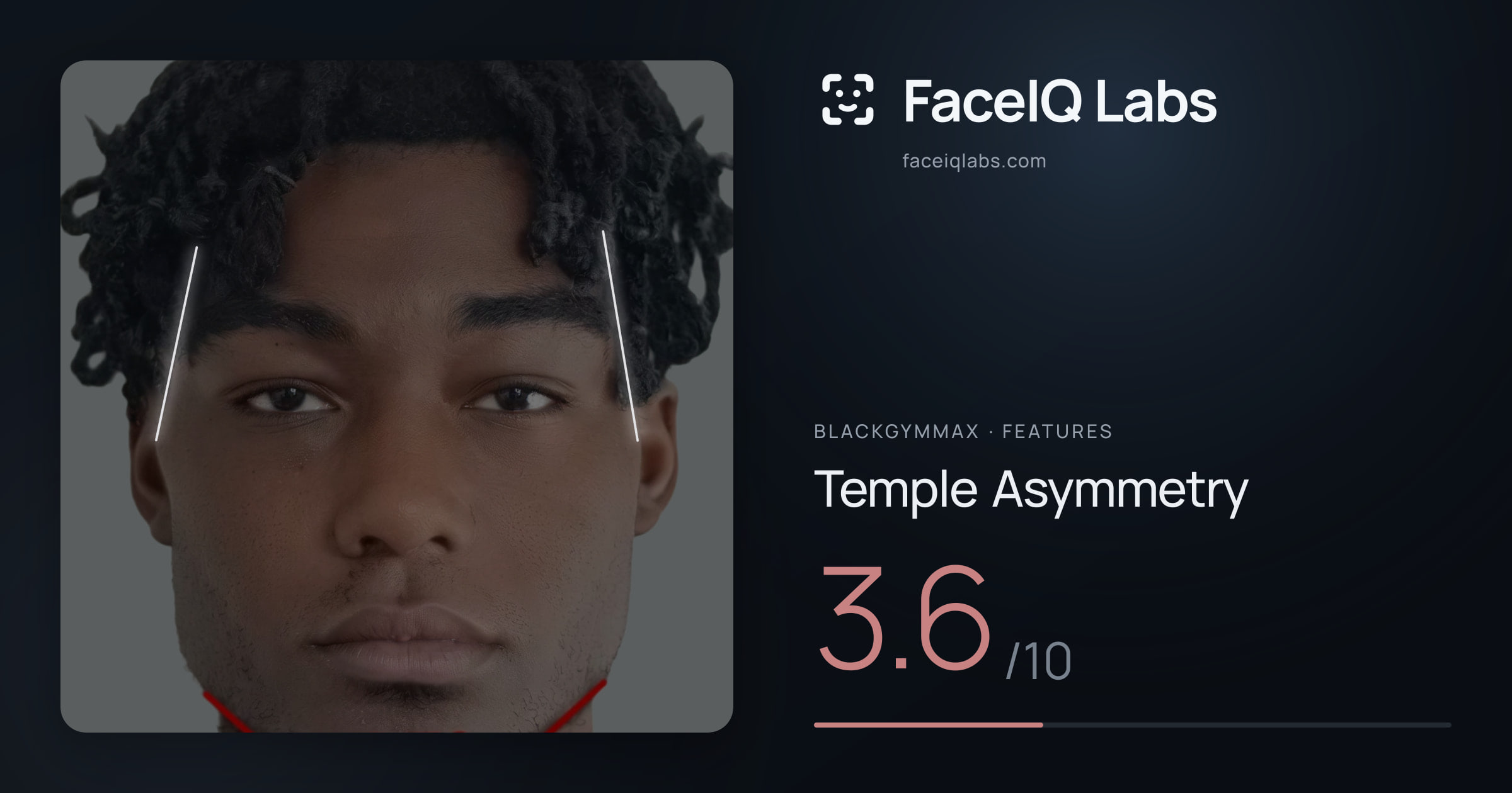 Blackgymmax Temple Asymmetry: 3.6/10, drawn on the photo
