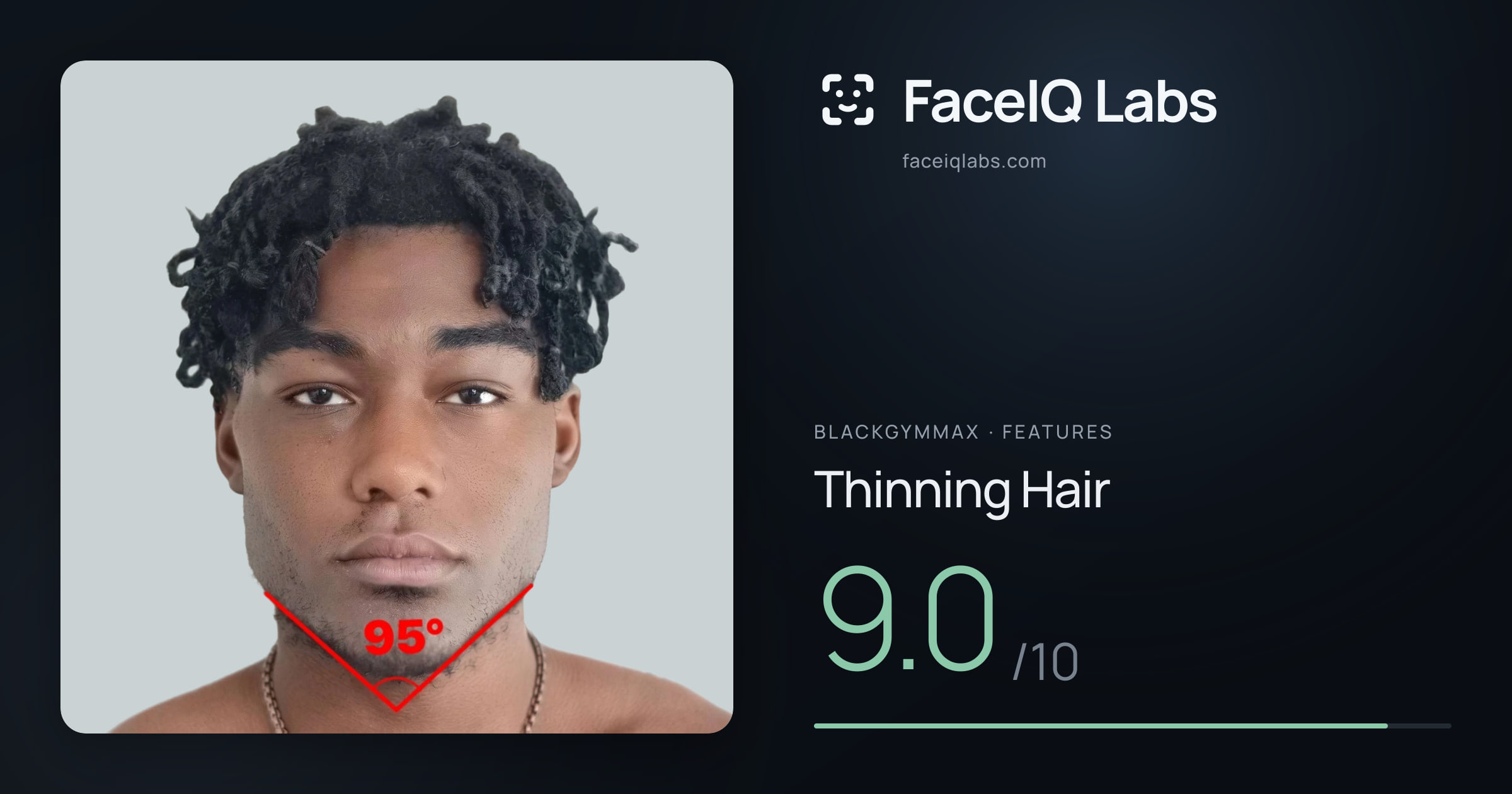 Blackgymmax Thinning Hair: 9.0/10, drawn on the photo