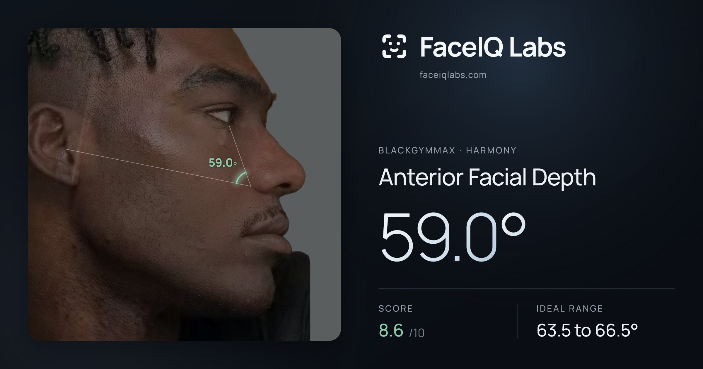 Blackgymmax Anterior Facial Depth: 59.0°, drawn on the photo