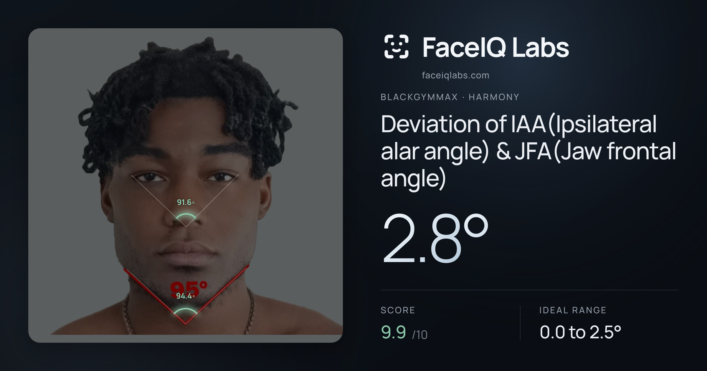Blackgymmax Deviation of IAA(Ipsilateral alar angle) & JFA(Jaw frontal angle): 2.8°, drawn on the photo