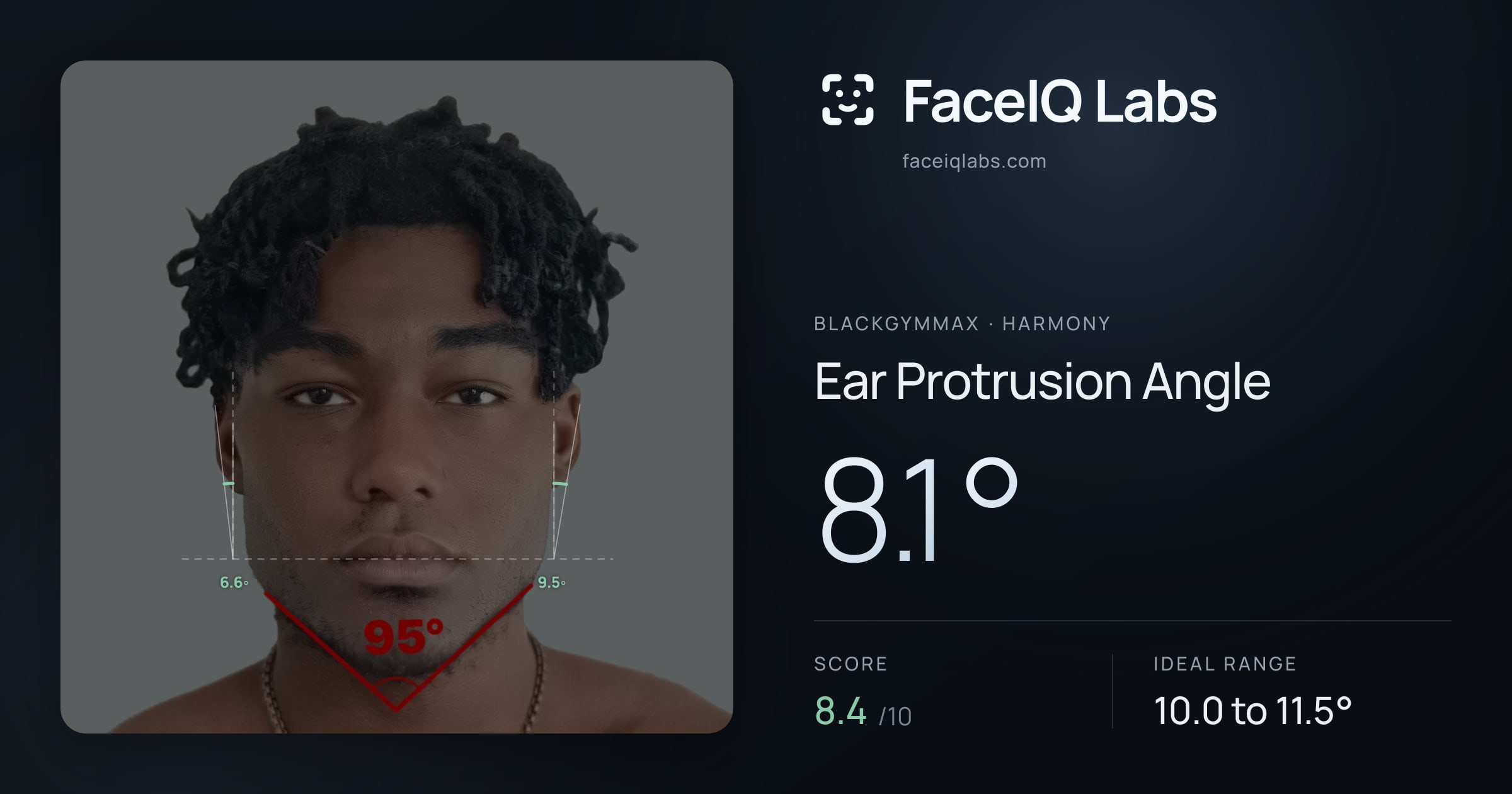Blackgymmax Ear Protrusion Angle: 8.1°, drawn on the photo