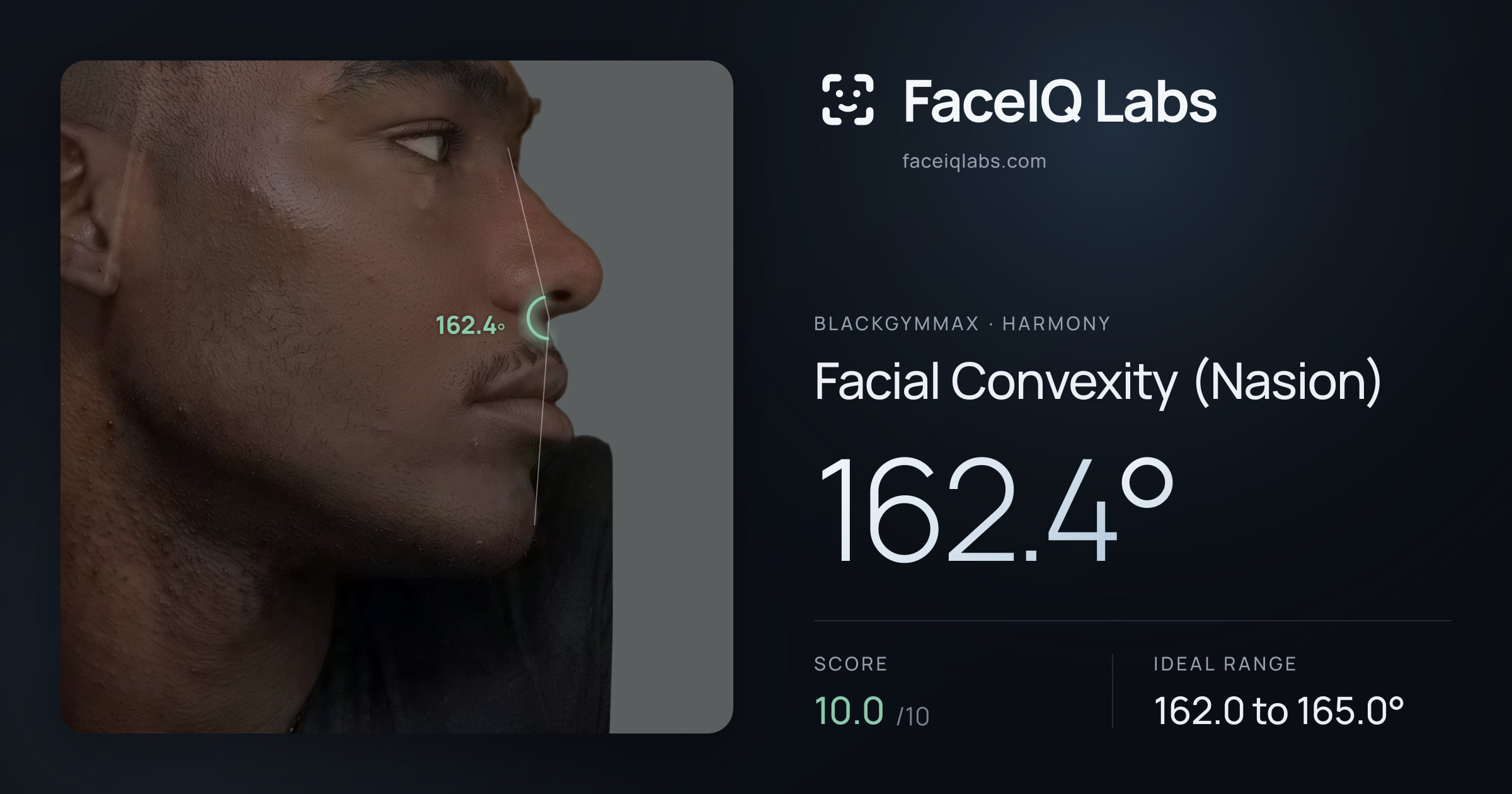 Blackgymmax Facial Convexity (Nasion): 162.4°, drawn on the photo