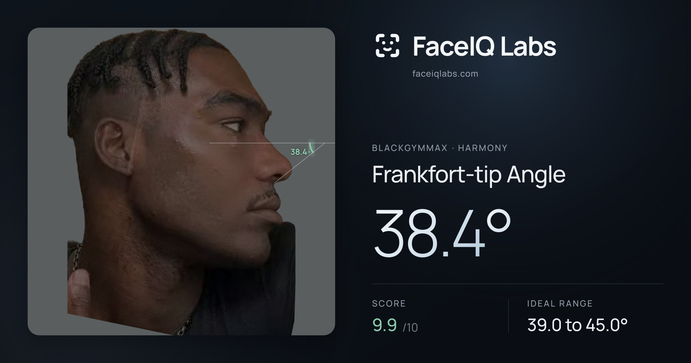 Blackgymmax Frankfort-tip Angle: 38.4°, drawn on the photo