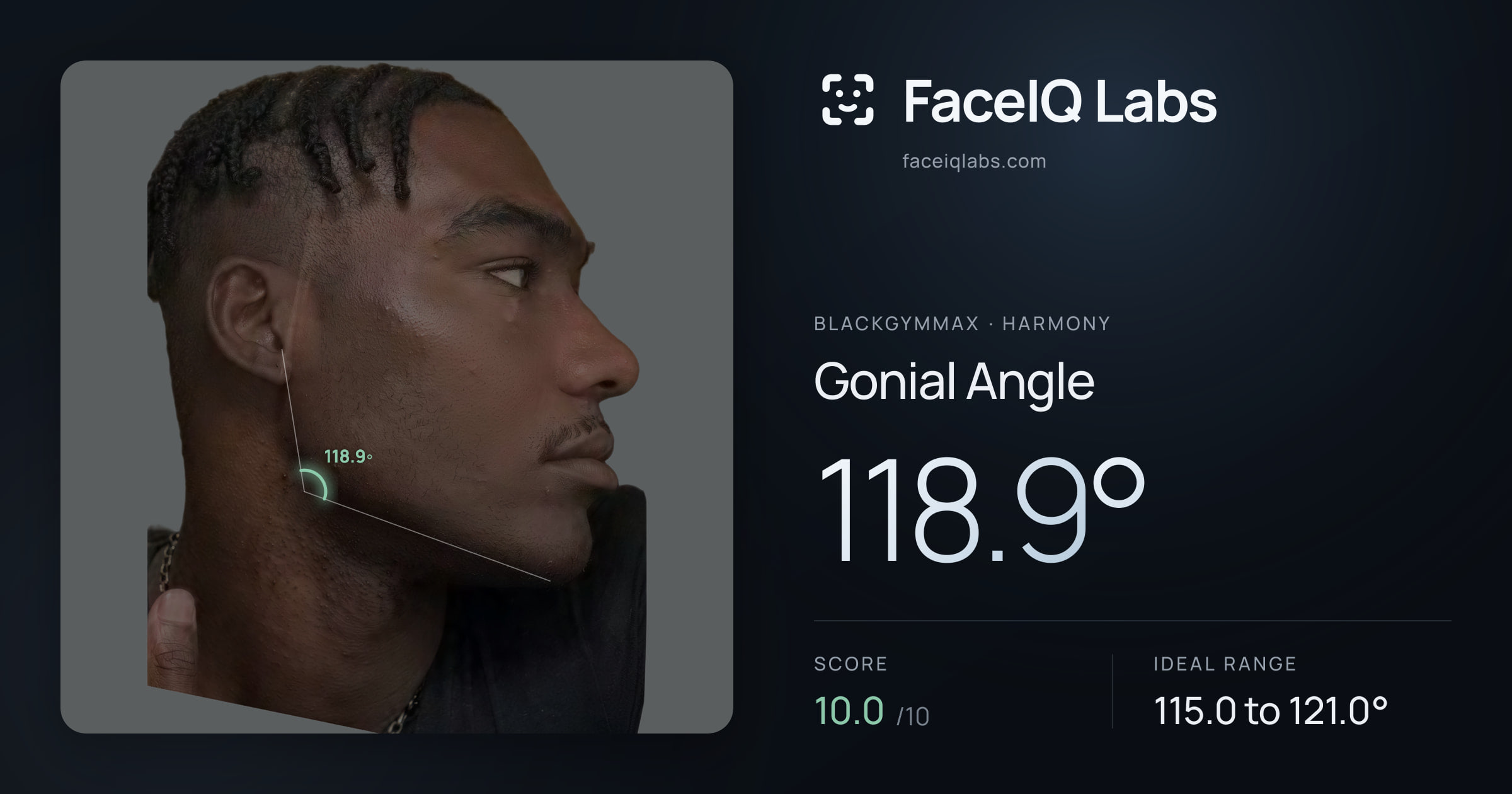 Blackgymmax Gonial Angle: 118.9°, drawn on the photo