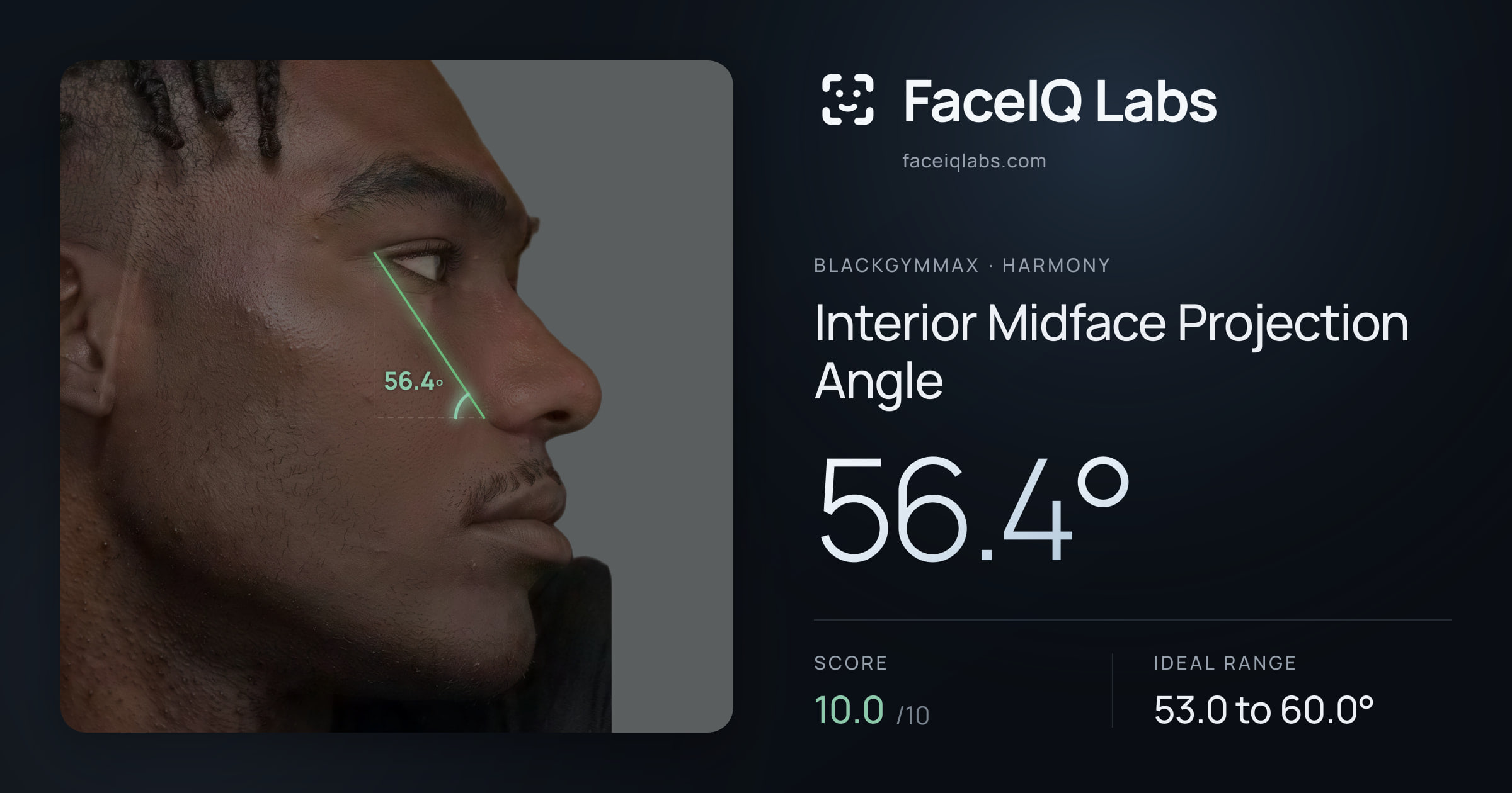 Blackgymmax Interior Midface Projection Angle: 56.4°, drawn on the photo