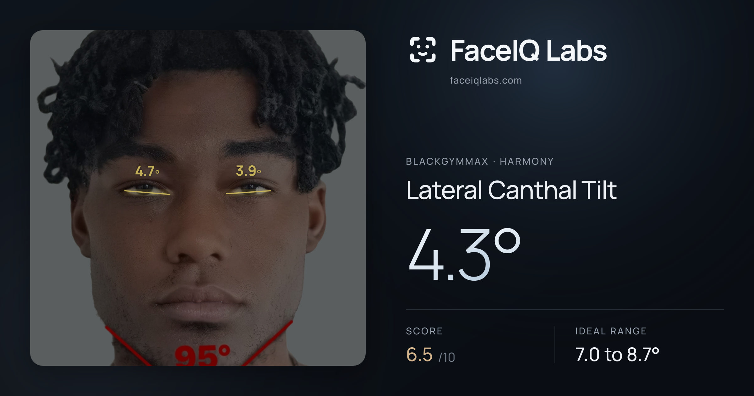 Blackgymmax Lateral Canthal Tilt: 4.3°, drawn on the photo