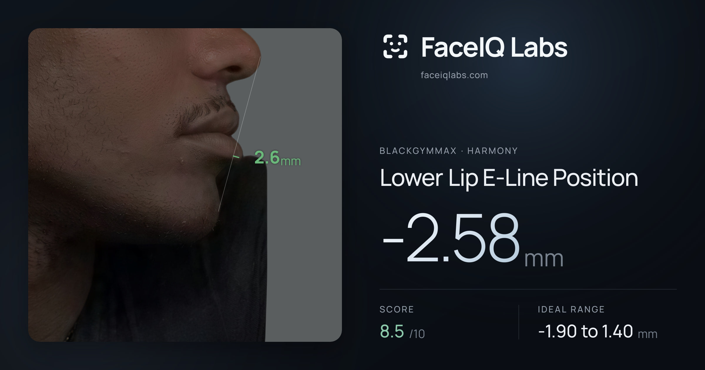 Blackgymmax Lower Lip E-Line Position: -2.58mm, drawn on the photo
