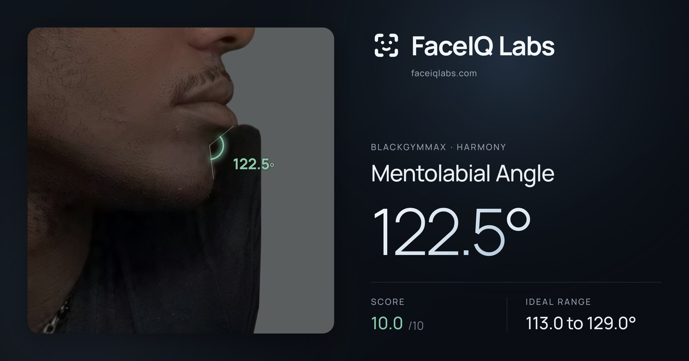 Blackgymmax Mentolabial Angle: 122.5°, drawn on the photo