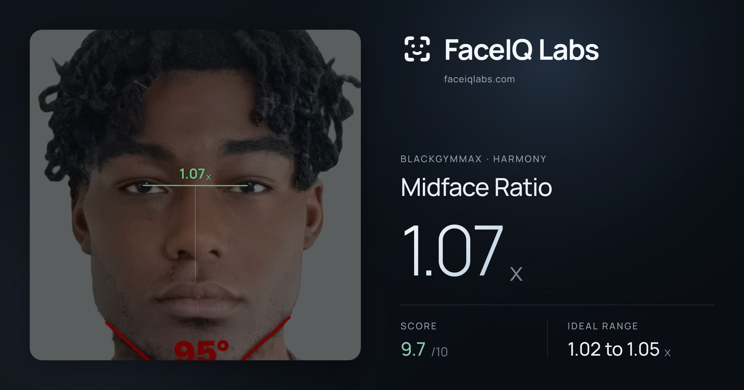 Blackgymmax Midface Ratio: 1.07x, drawn on the photo