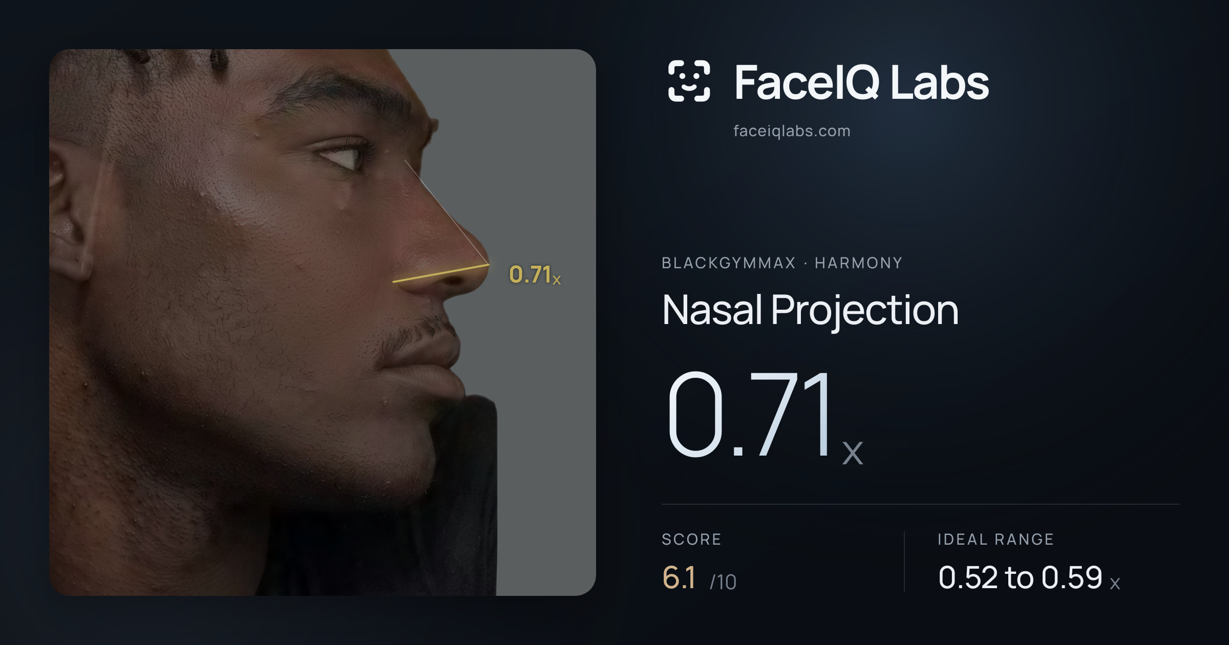 Blackgymmax Nasal Projection: 0.71x, drawn on the photo