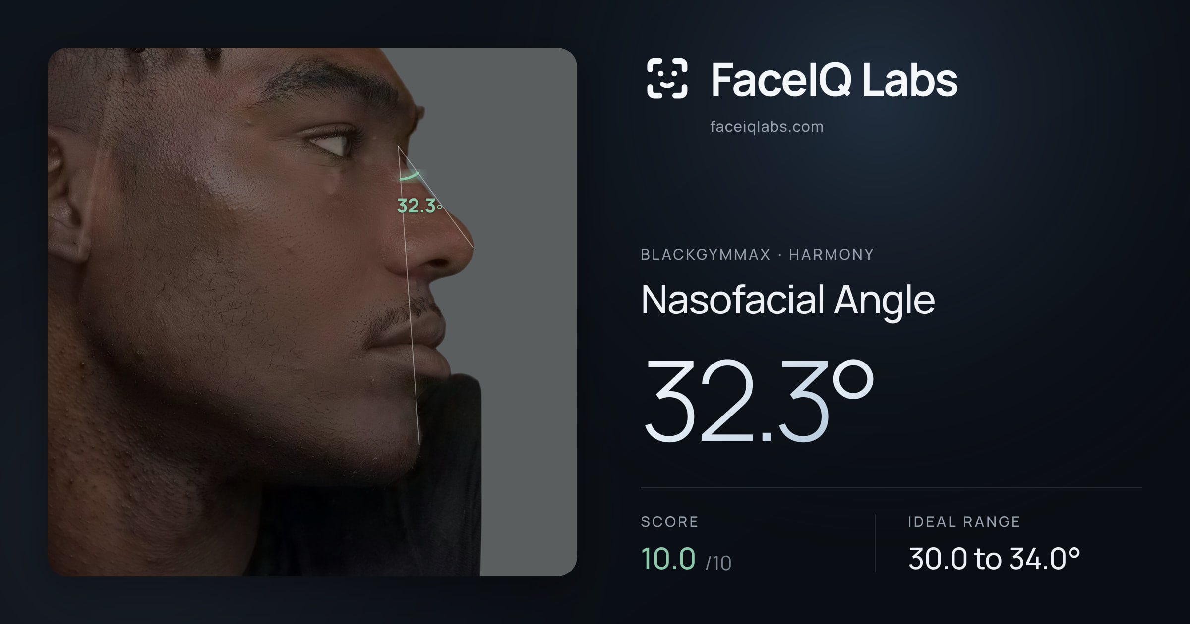 Blackgymmax Nasofacial Angle: 32.3°, drawn on the photo